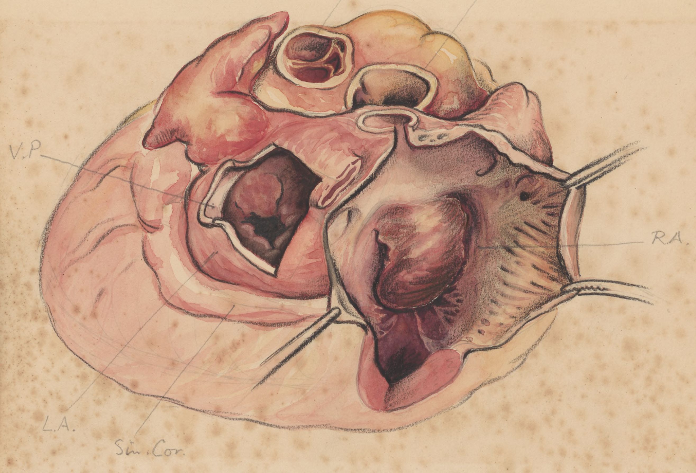 Heart