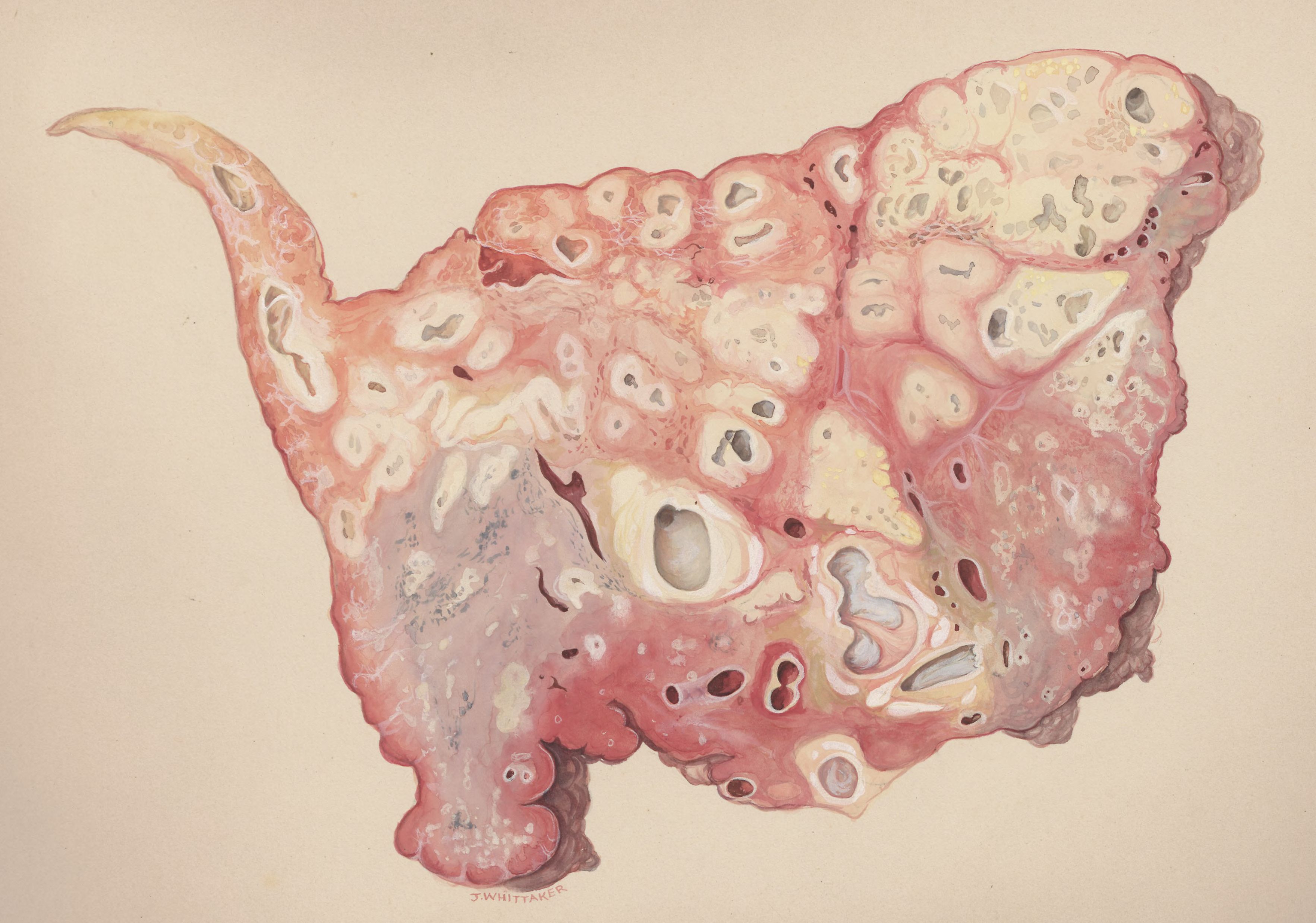 Lung tissue