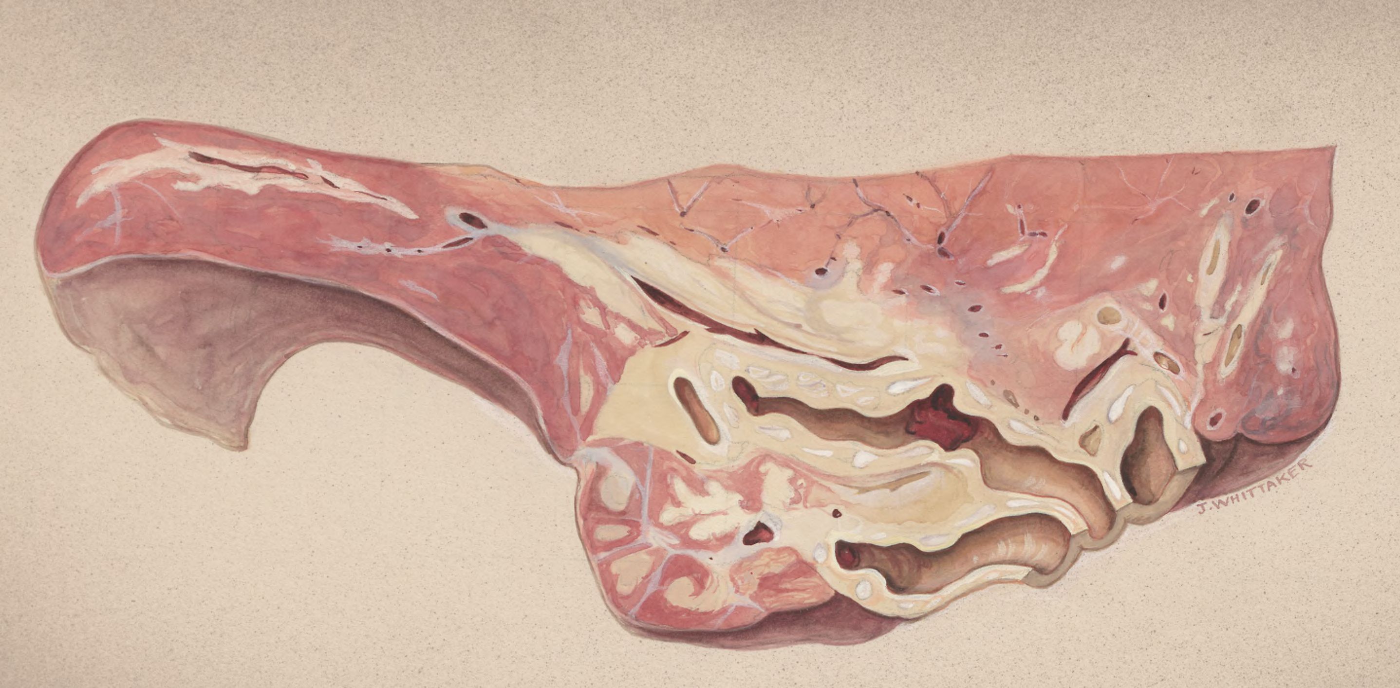 Lung tissue