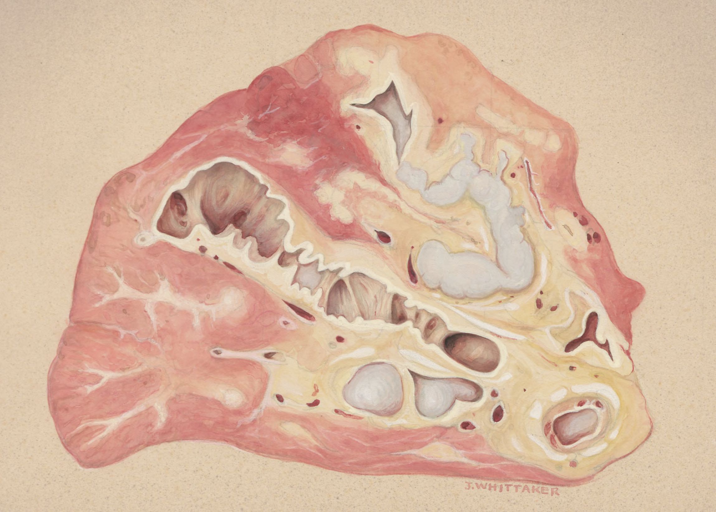 Lung tissue