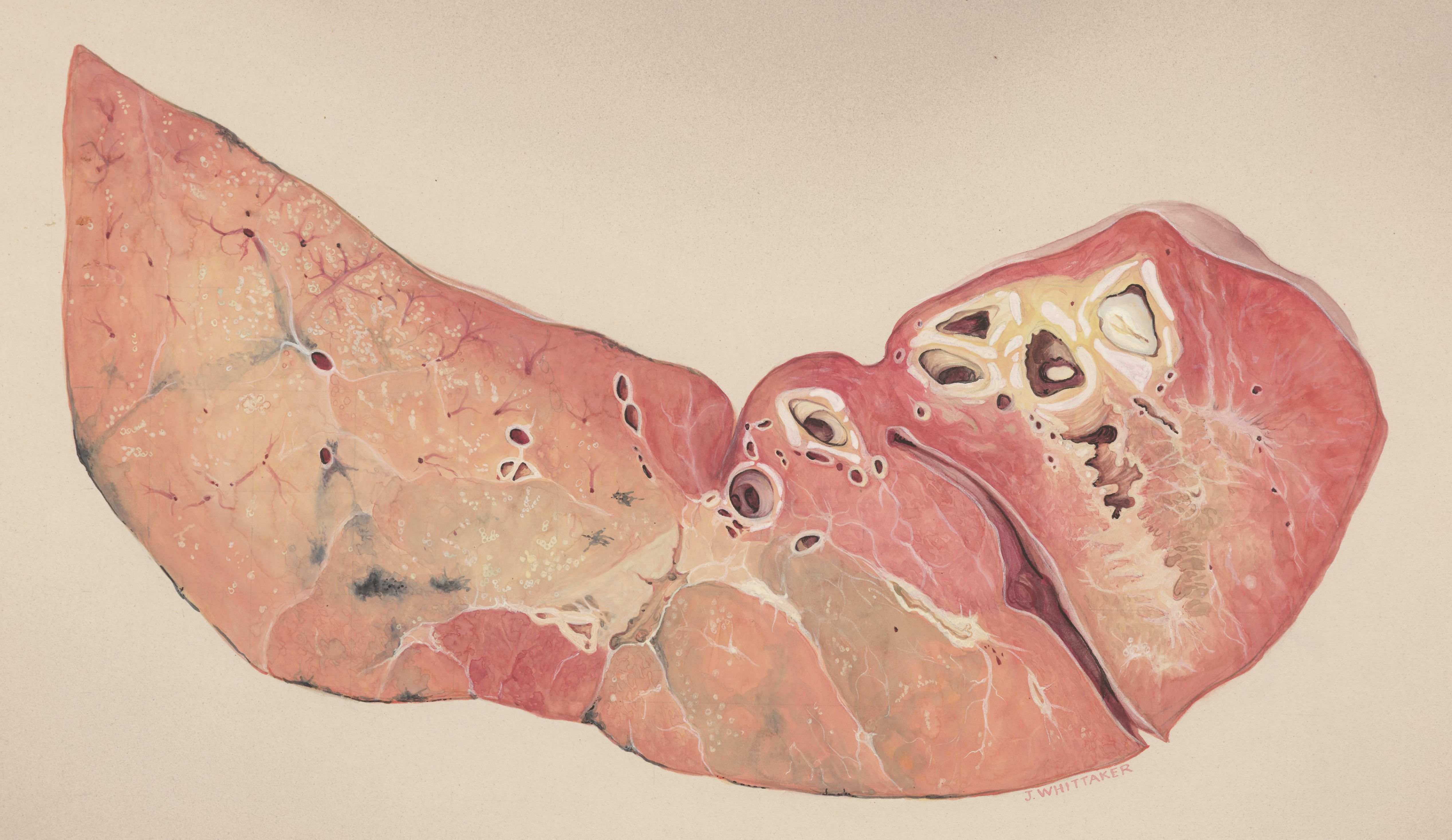 Lung tissue