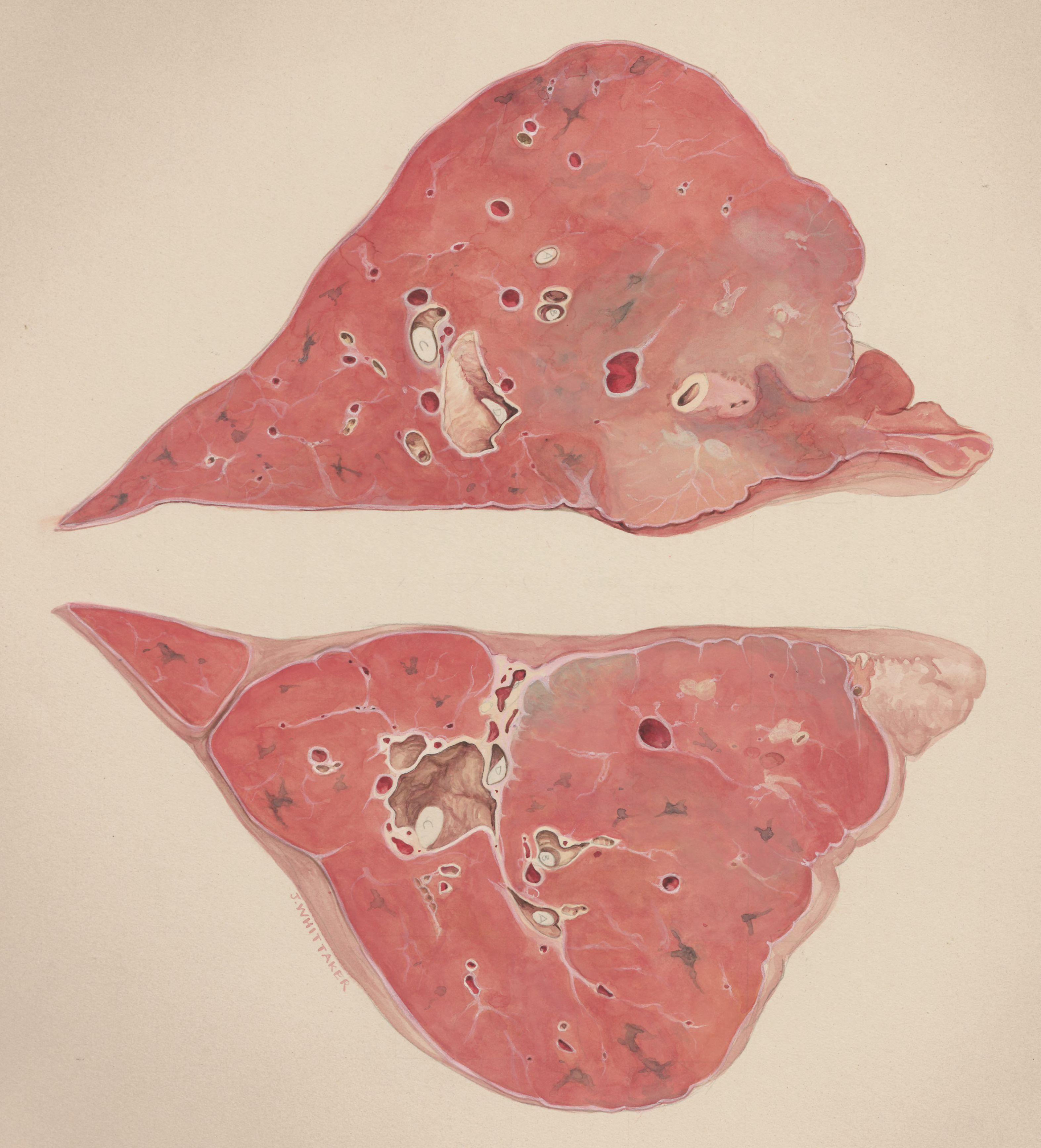 Lung tissue