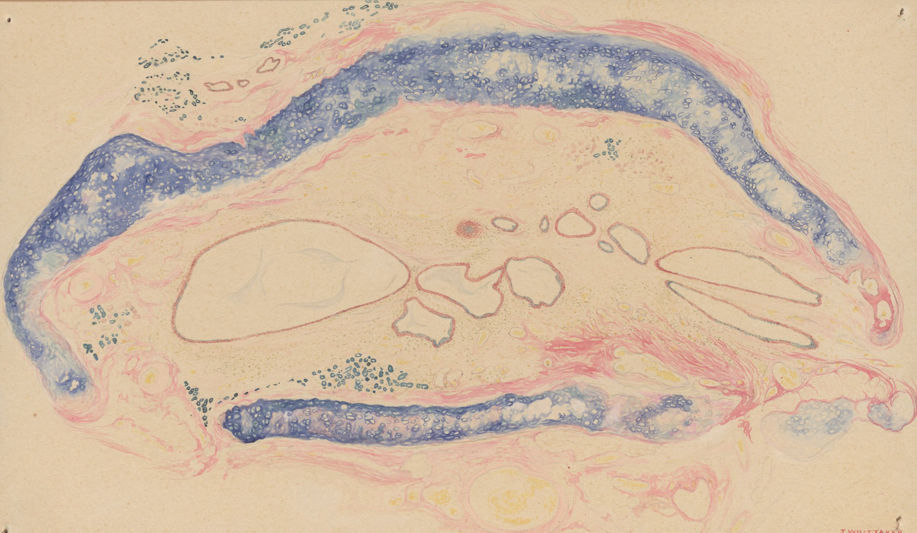 Lung tissue