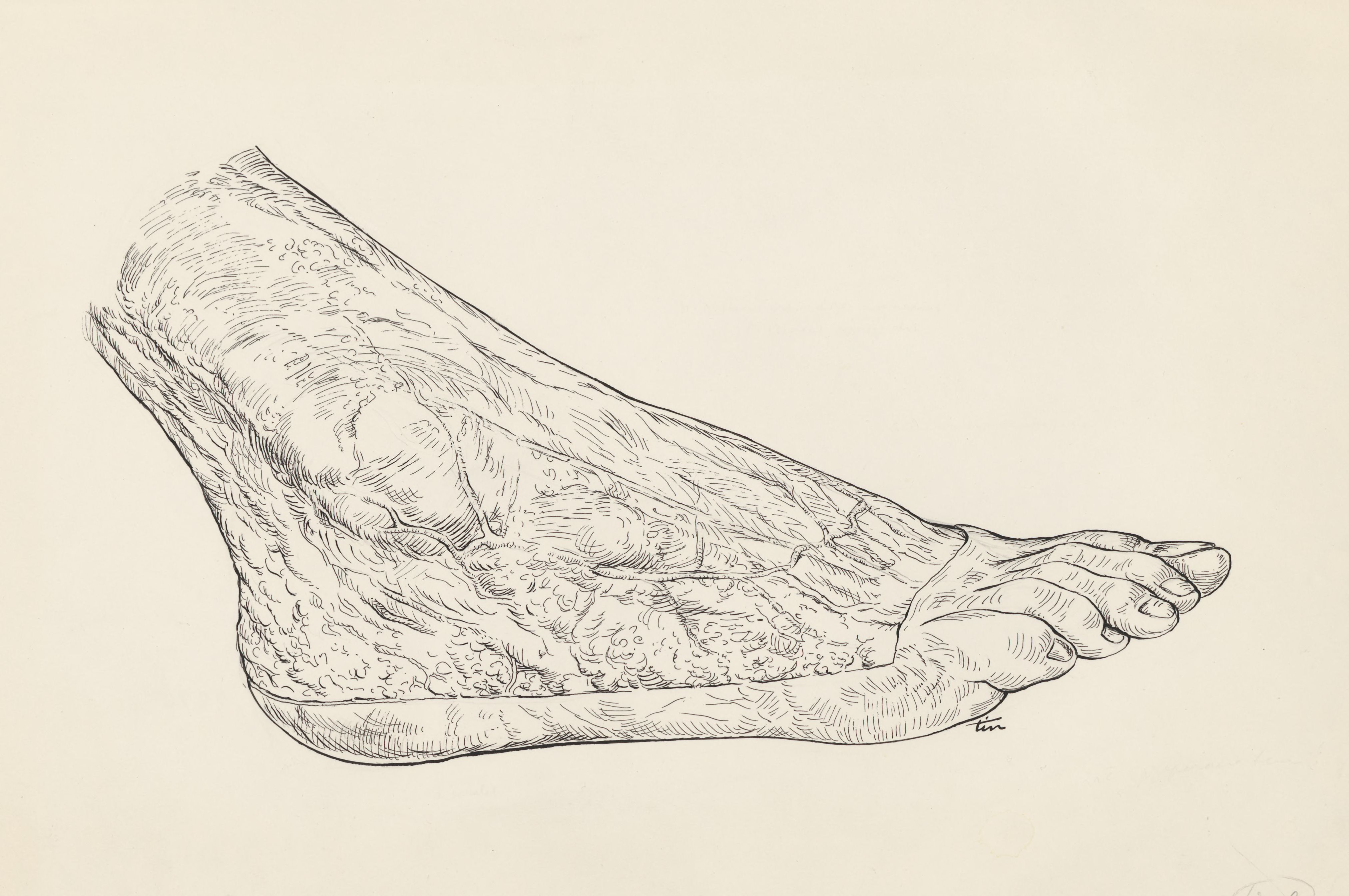 Skinned human foot
