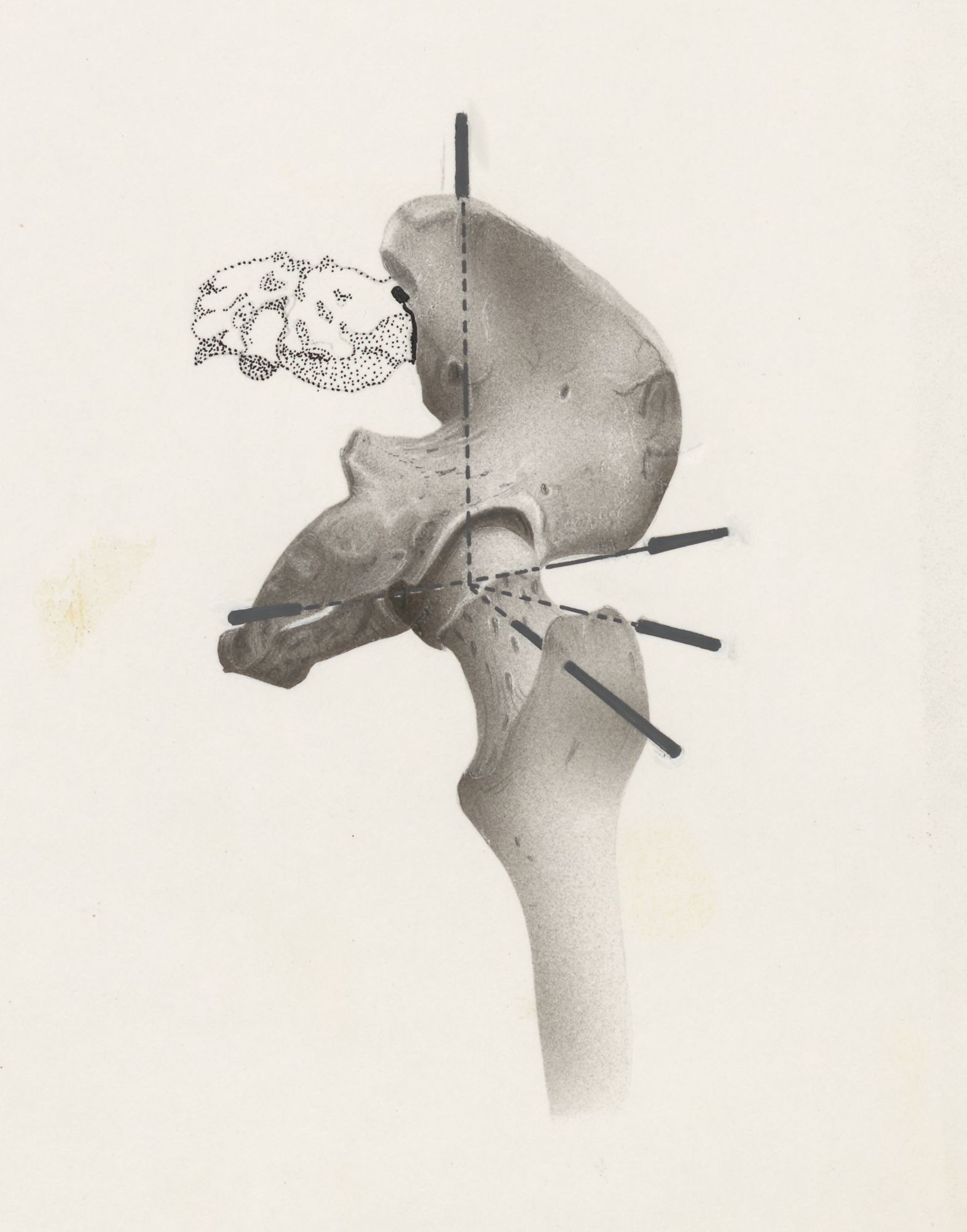 Hip joint