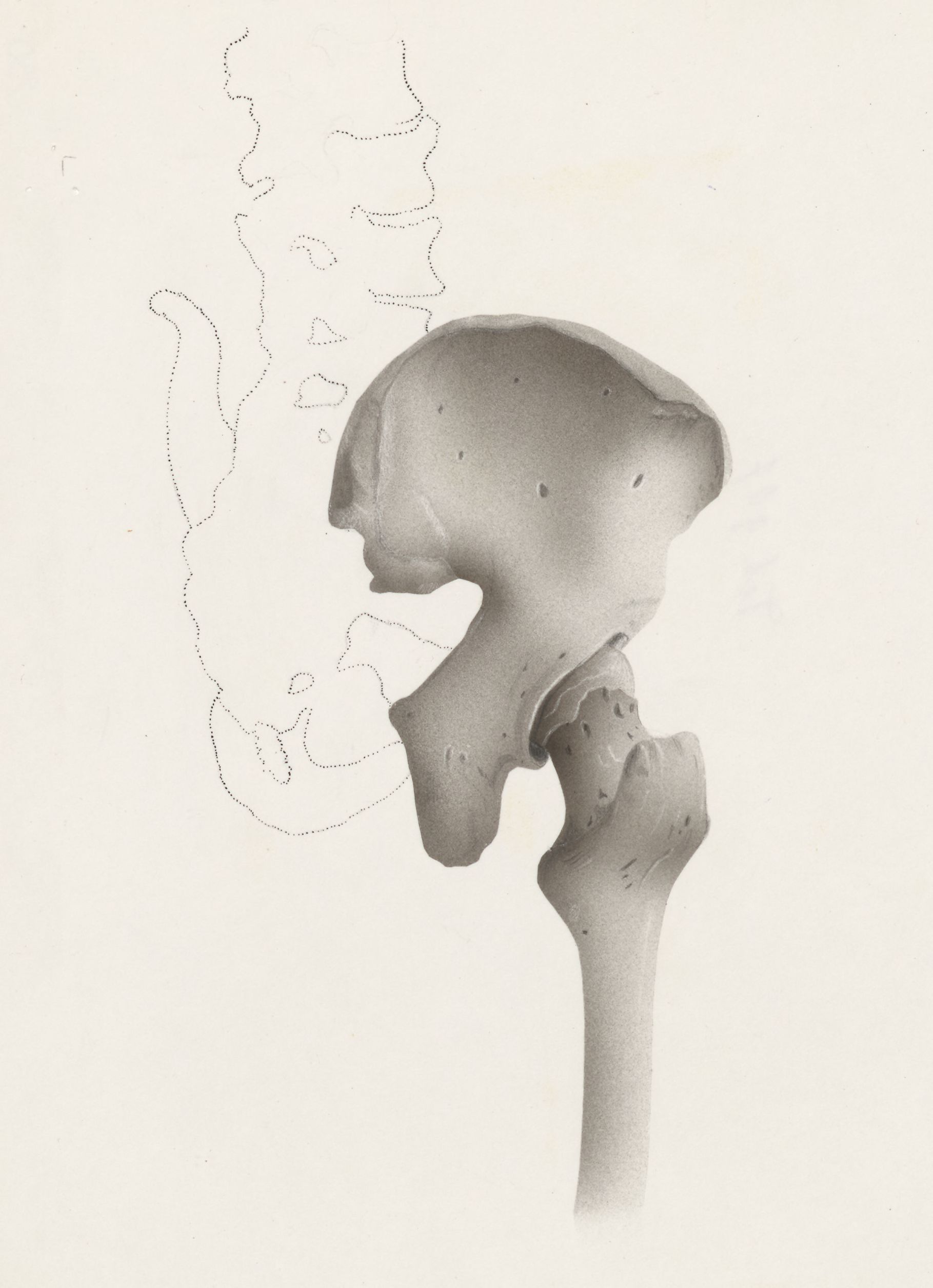 Hip joint