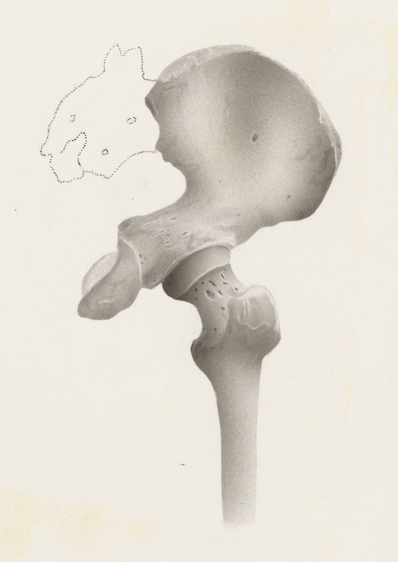 Hip joint