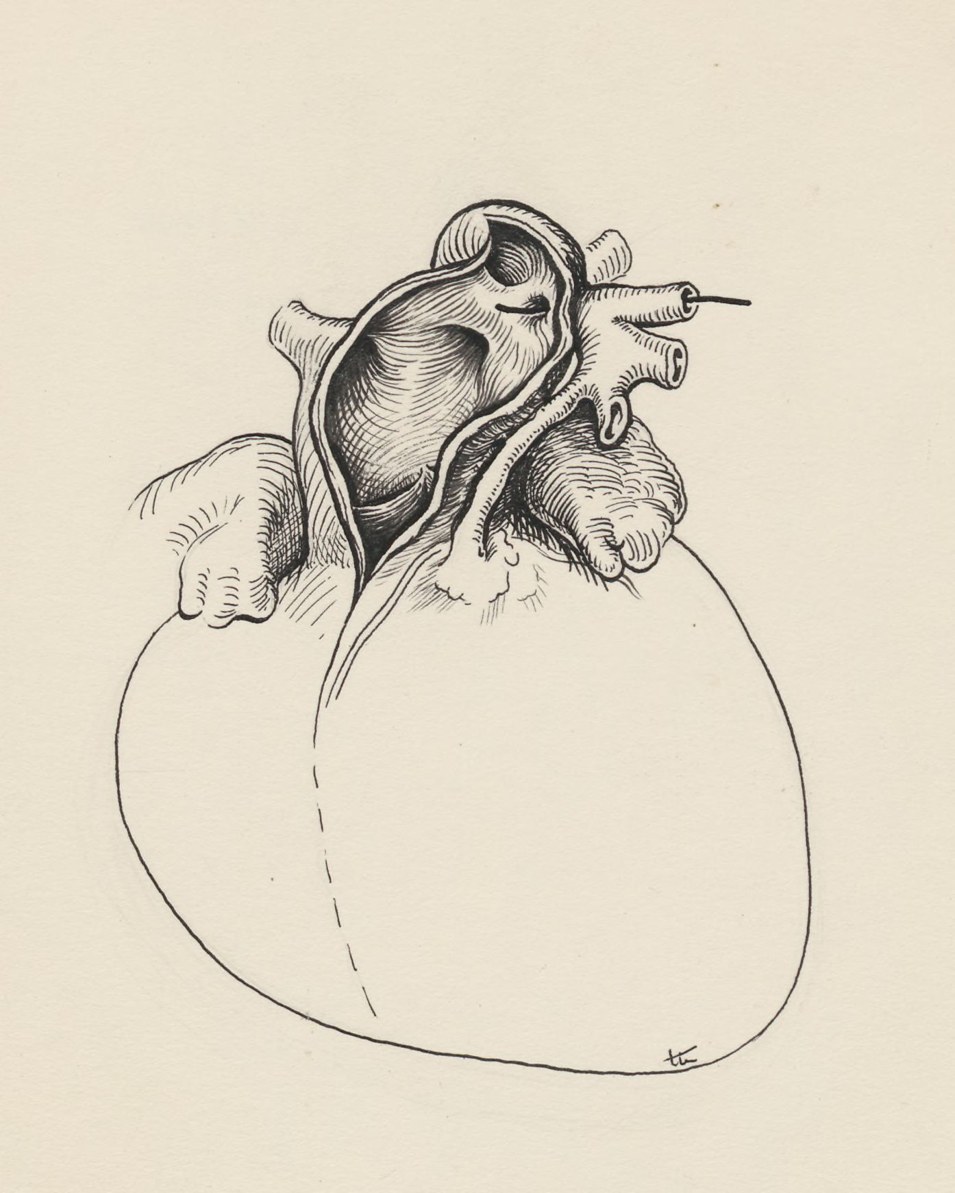 Cardiovascular system