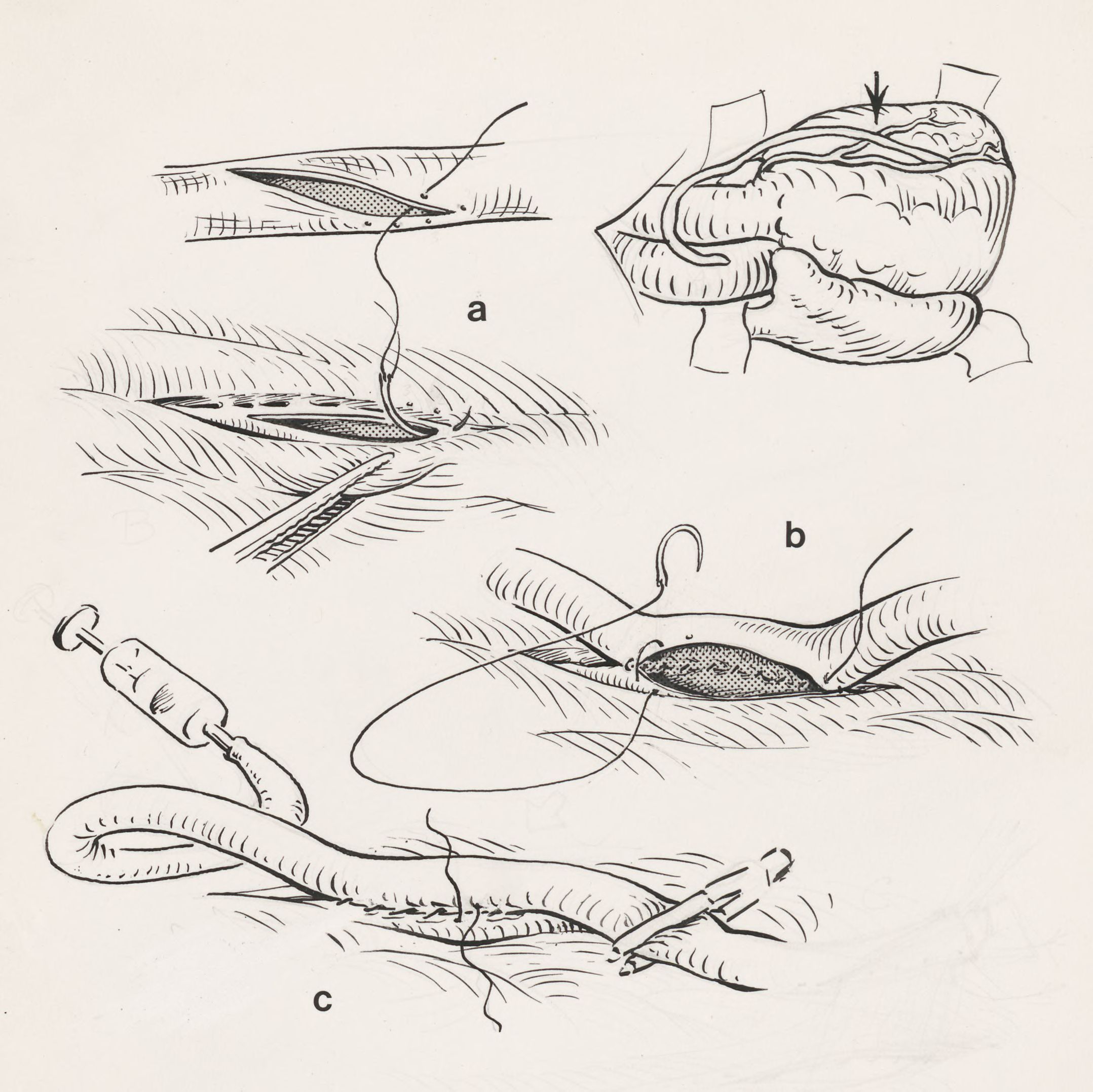Thorax surgery
