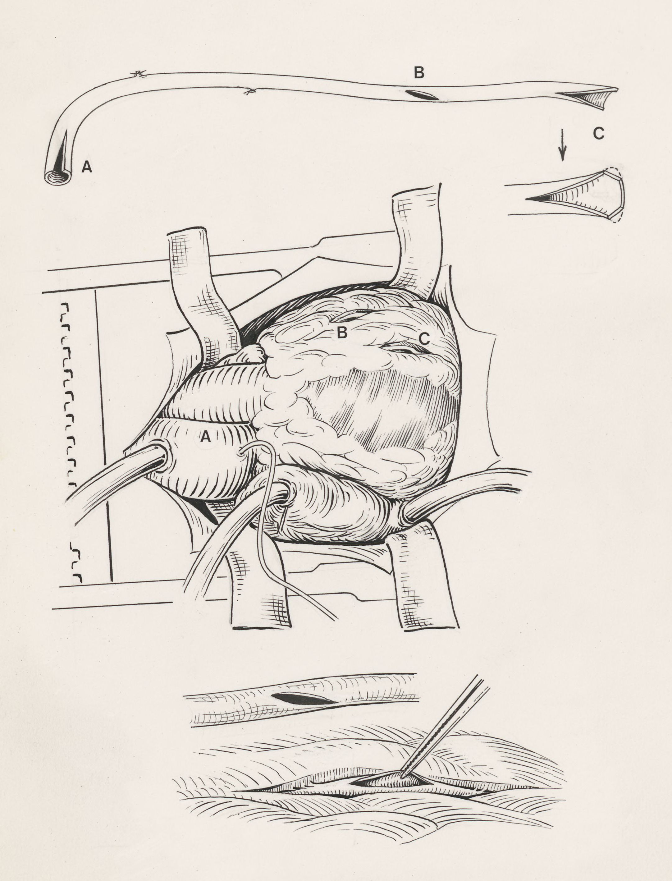 Thorax surgery
