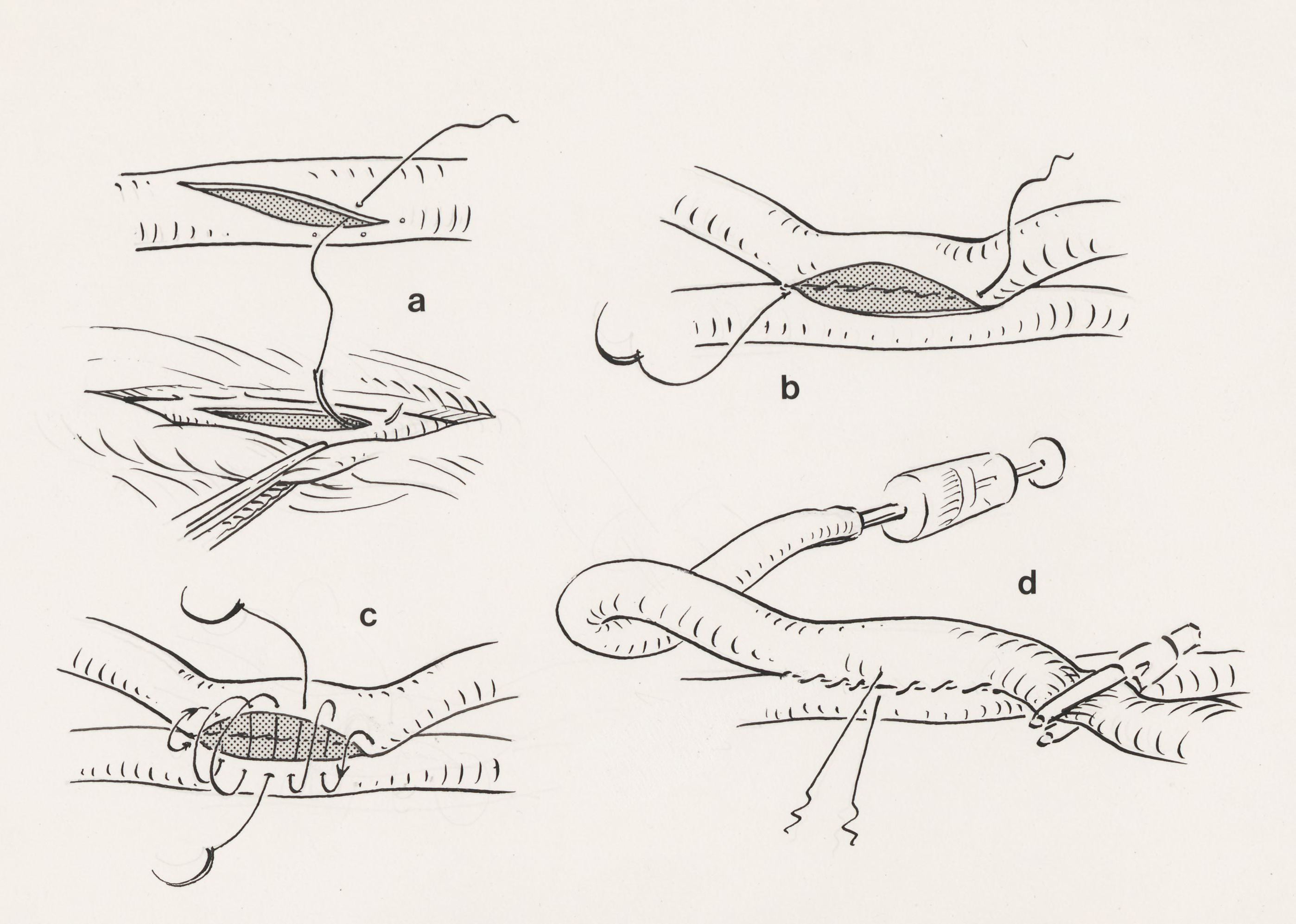 Thorax surgery
