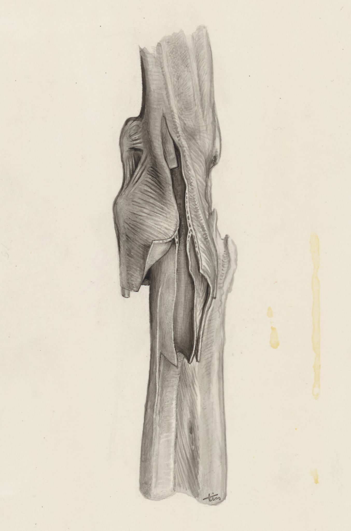 Musculoskeletal system of the wrist