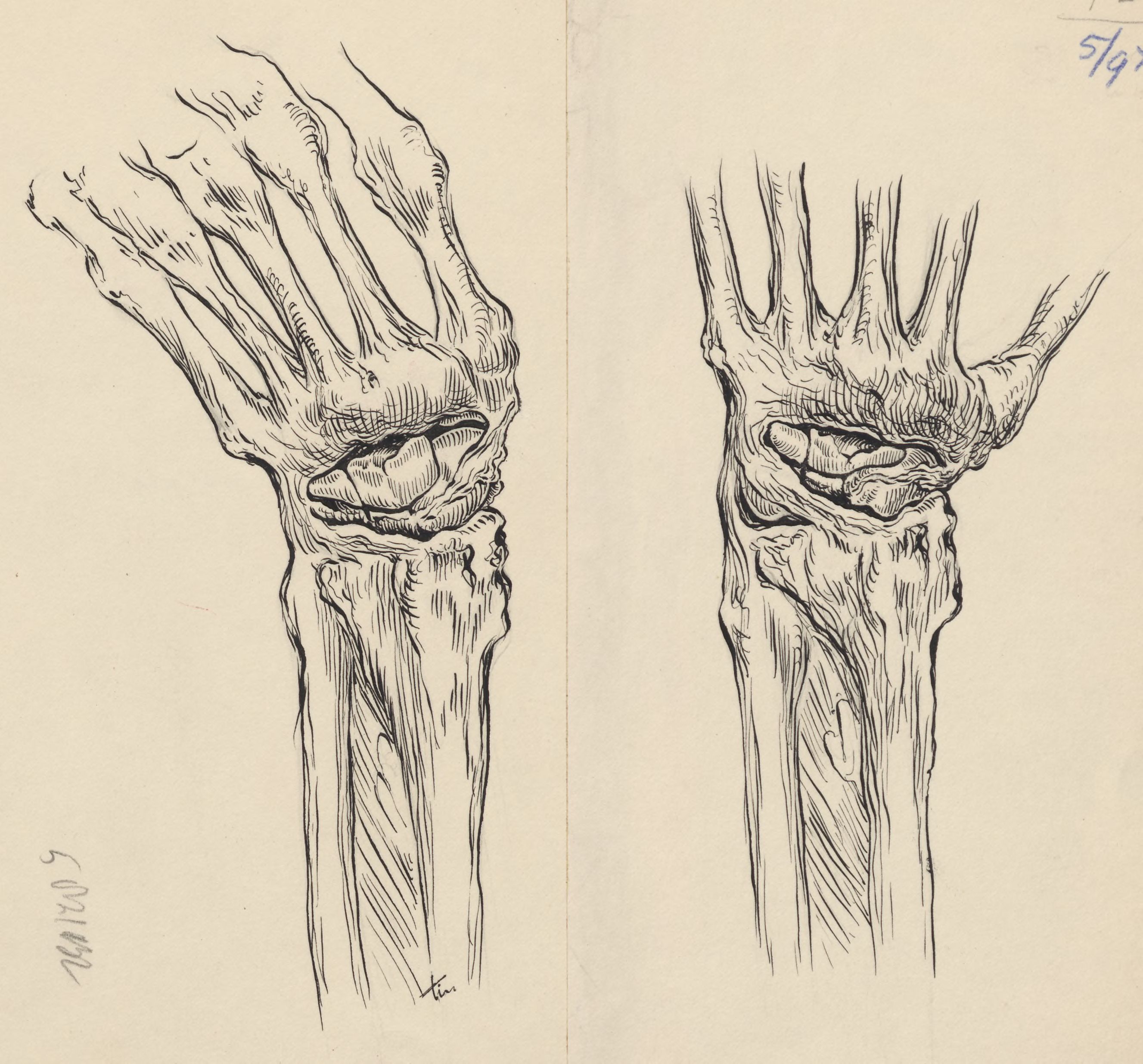 Musculoskeletal system of the hand and wrist