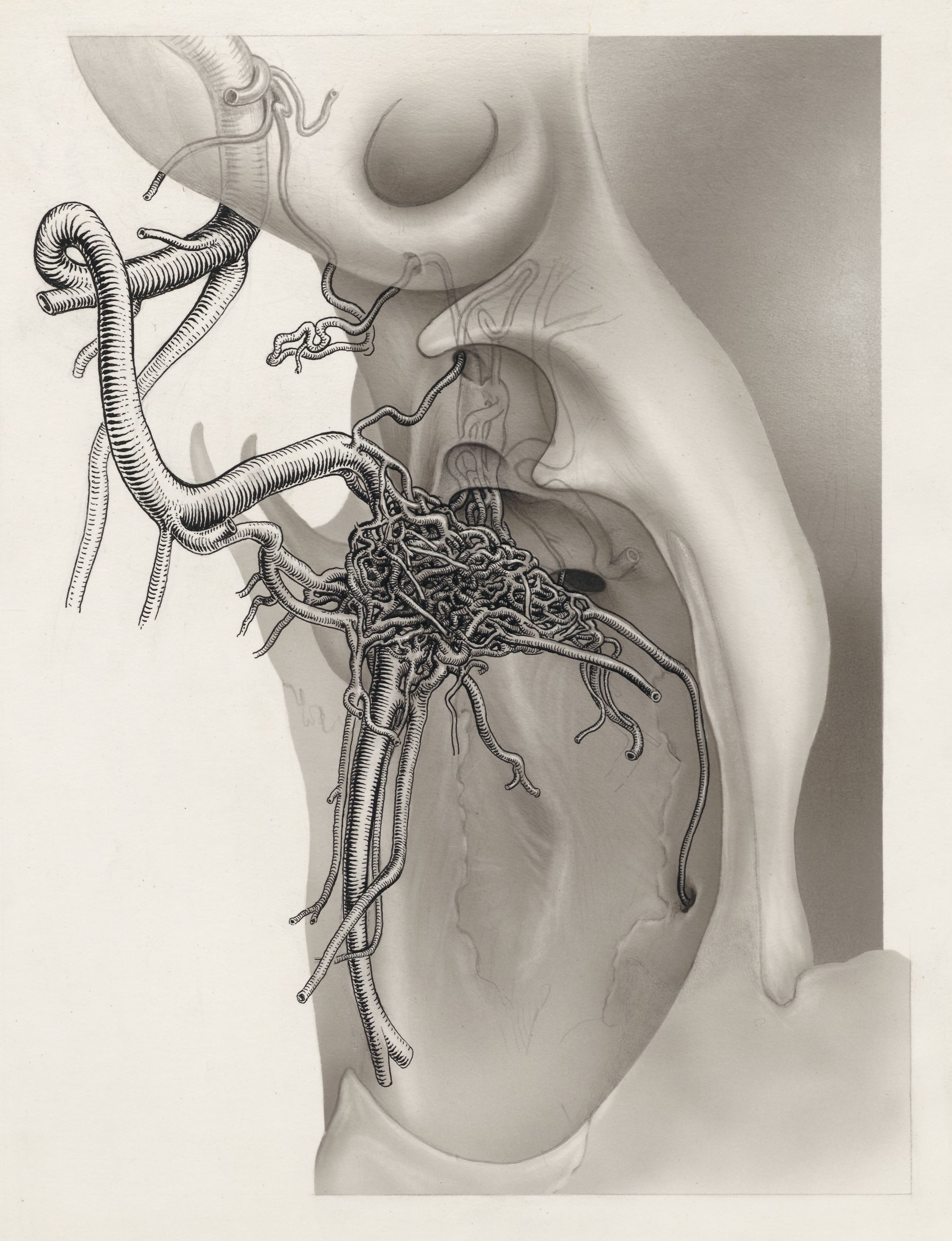 Nerves and other tissue of the neck and/or head