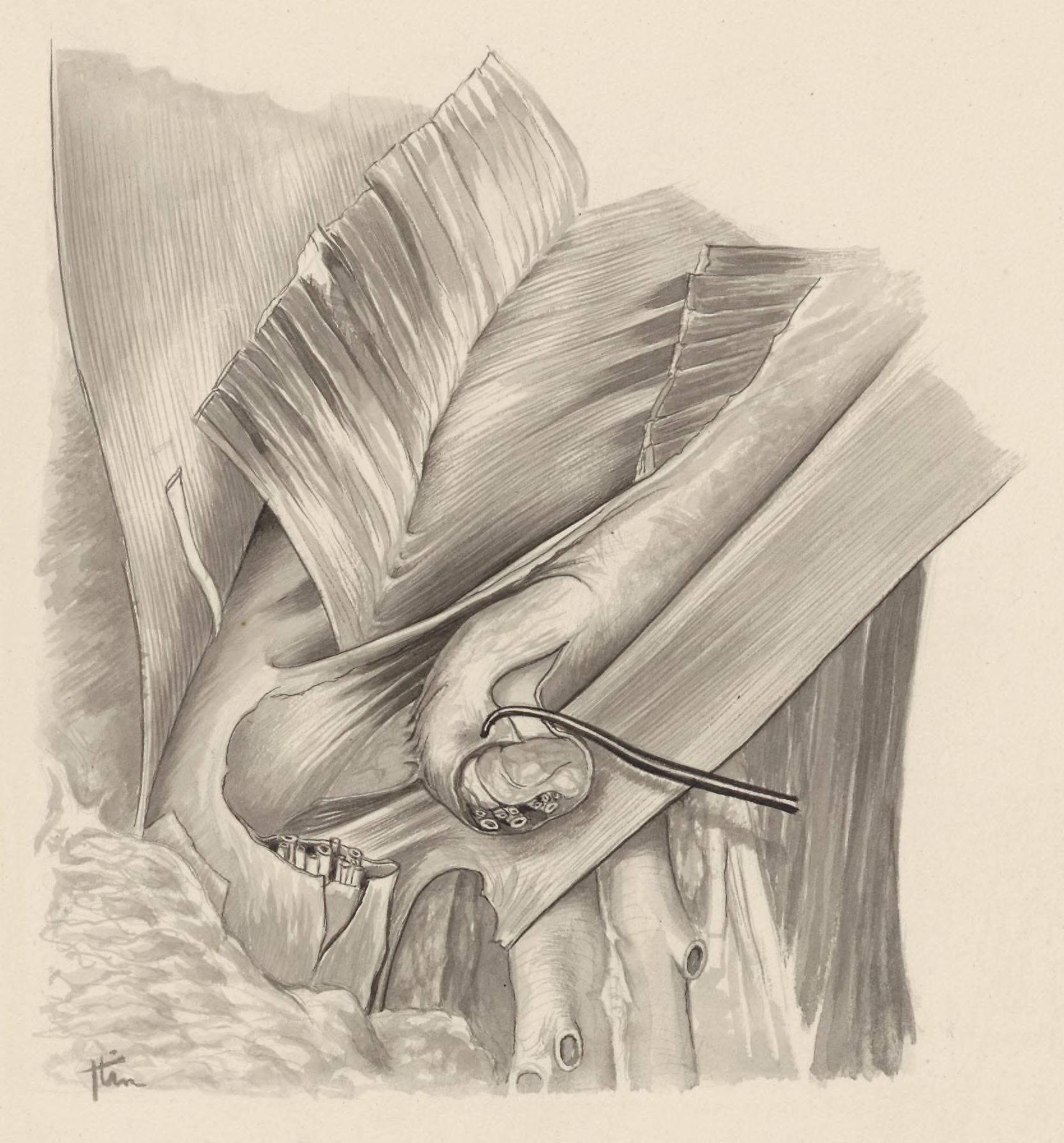 Tissue of the inguinal