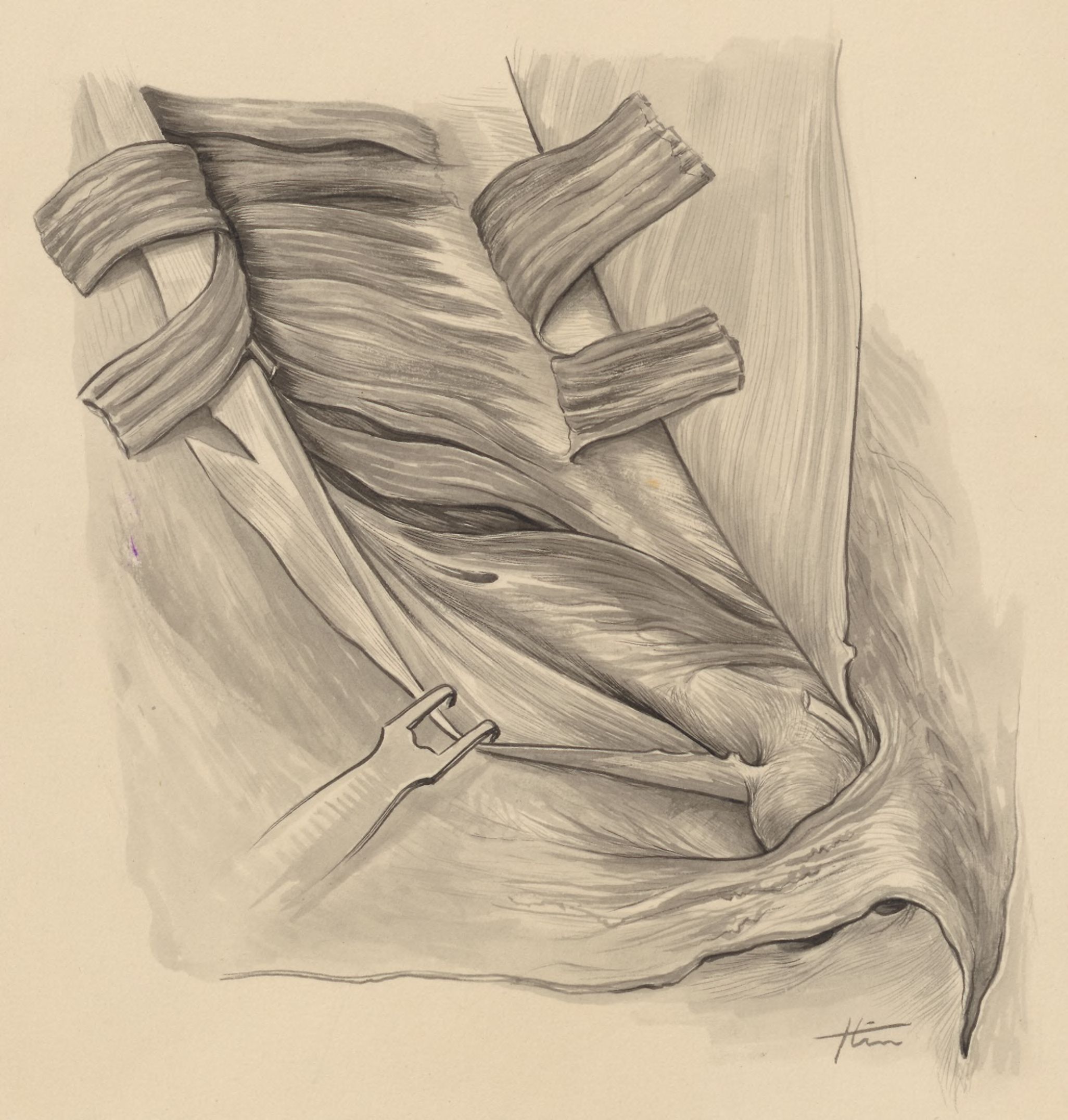 Tissue of the inguinal
