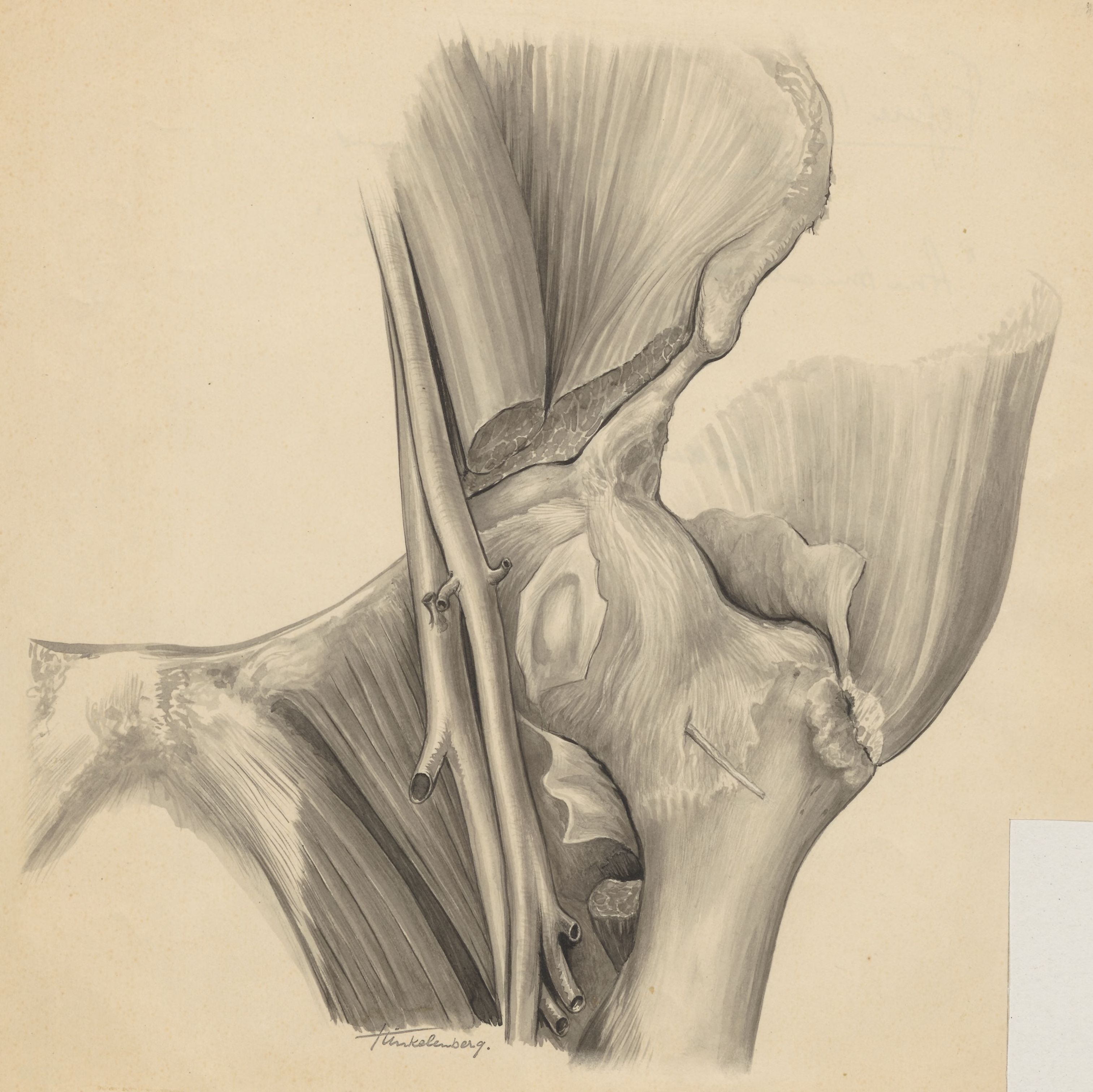 Musculoskeletal system of the hip