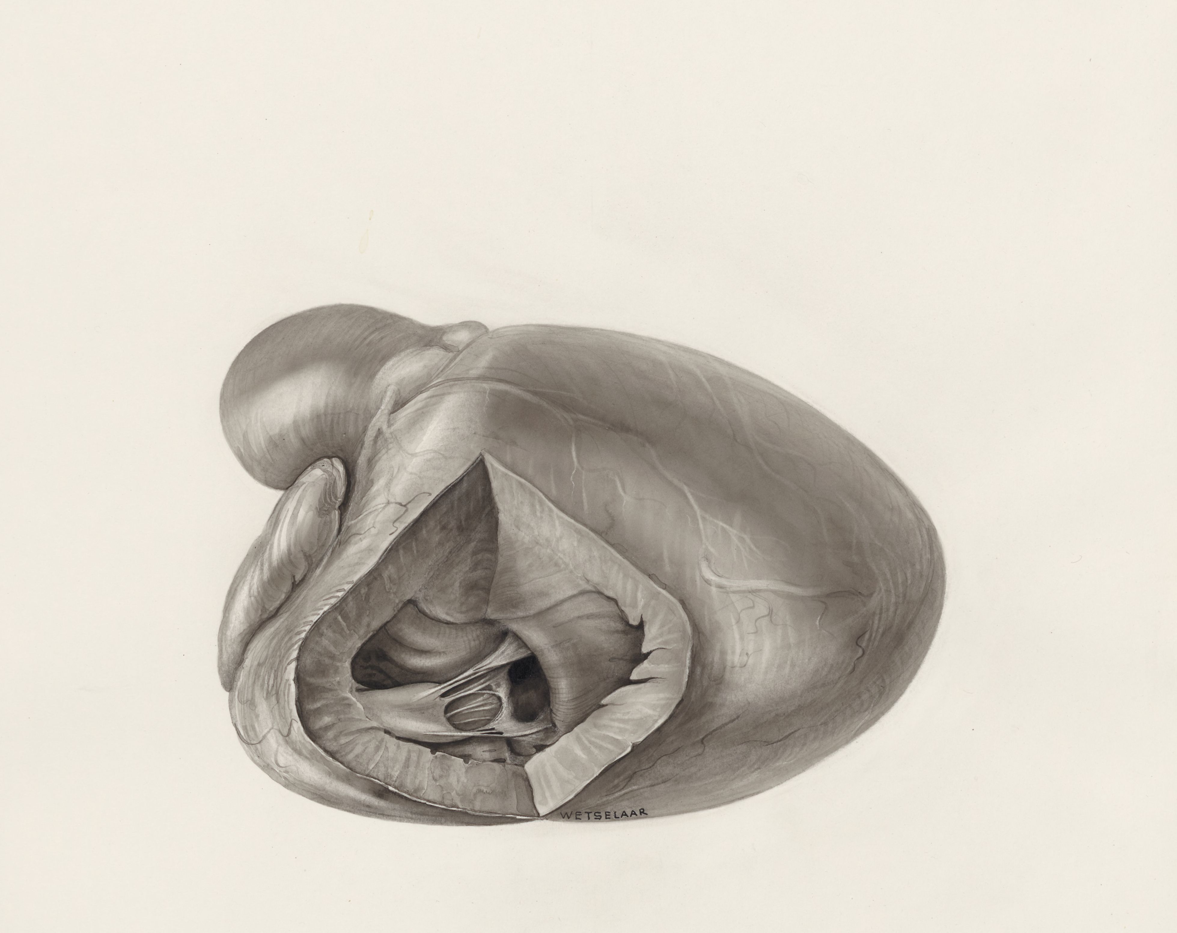 Cross section of a heart