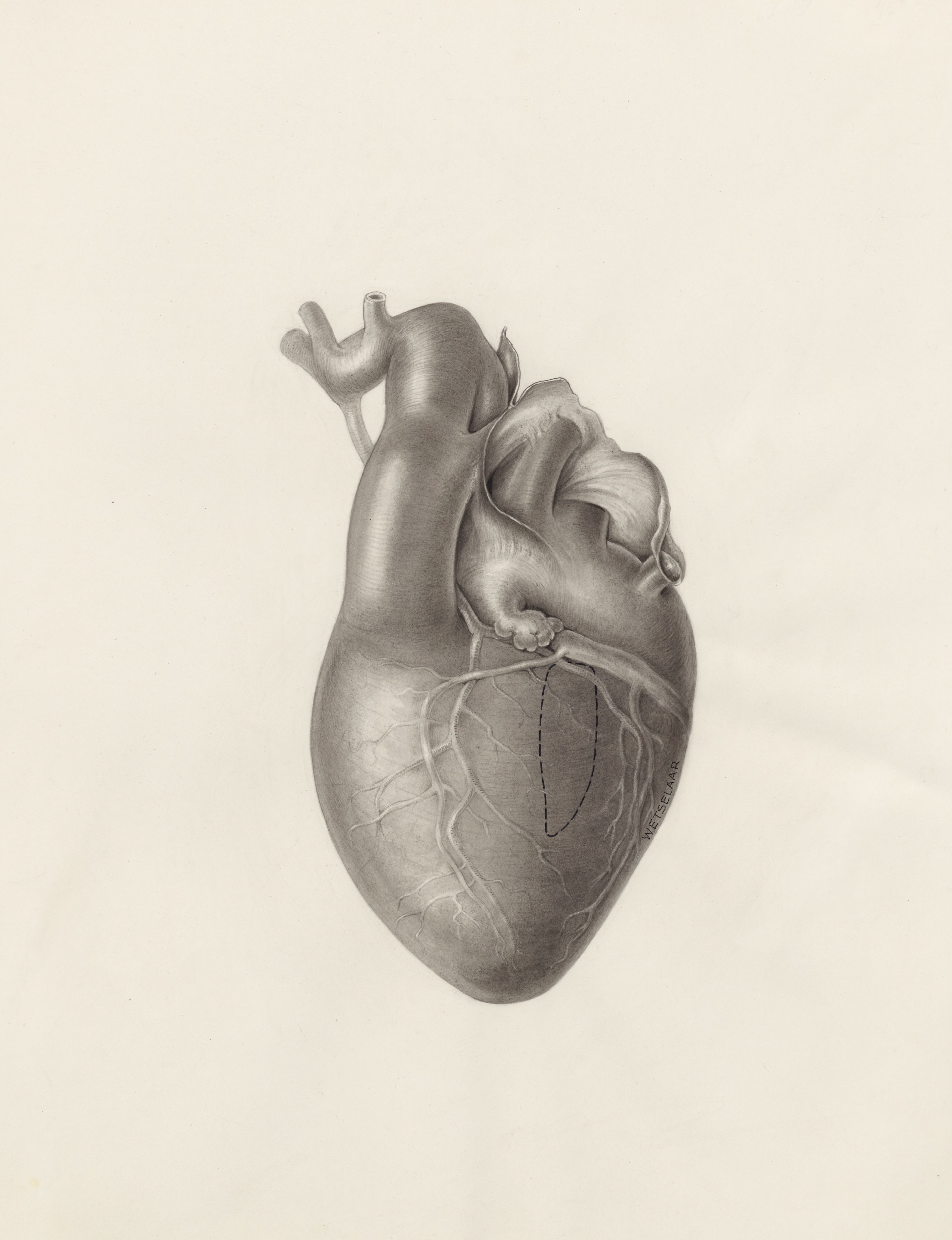 Cardiovascular system