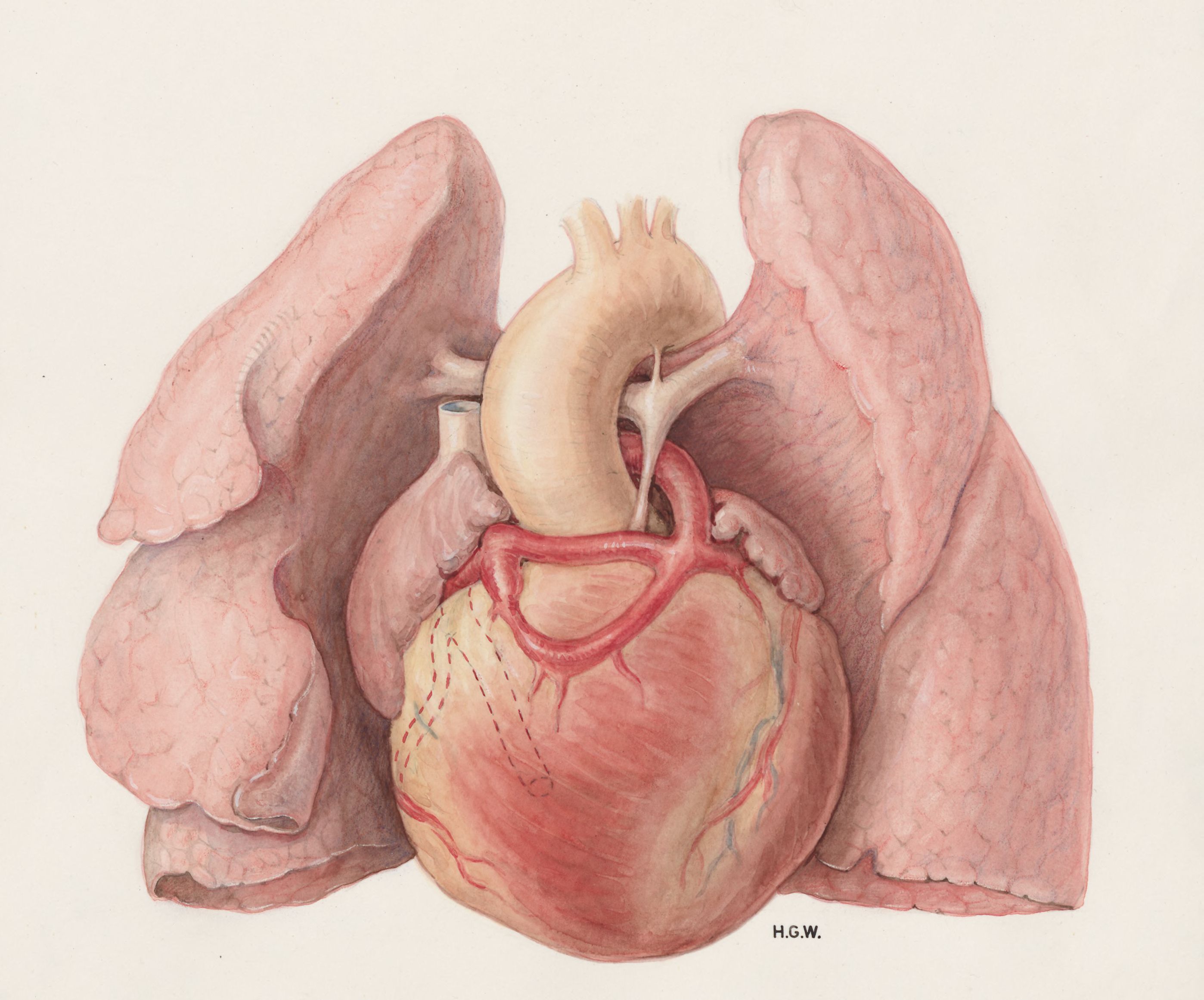 Heart and adjacent organs