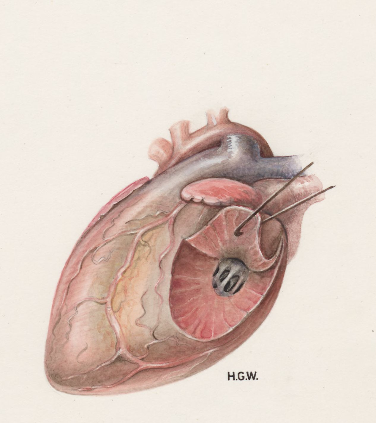 Heart and adjacent organs
