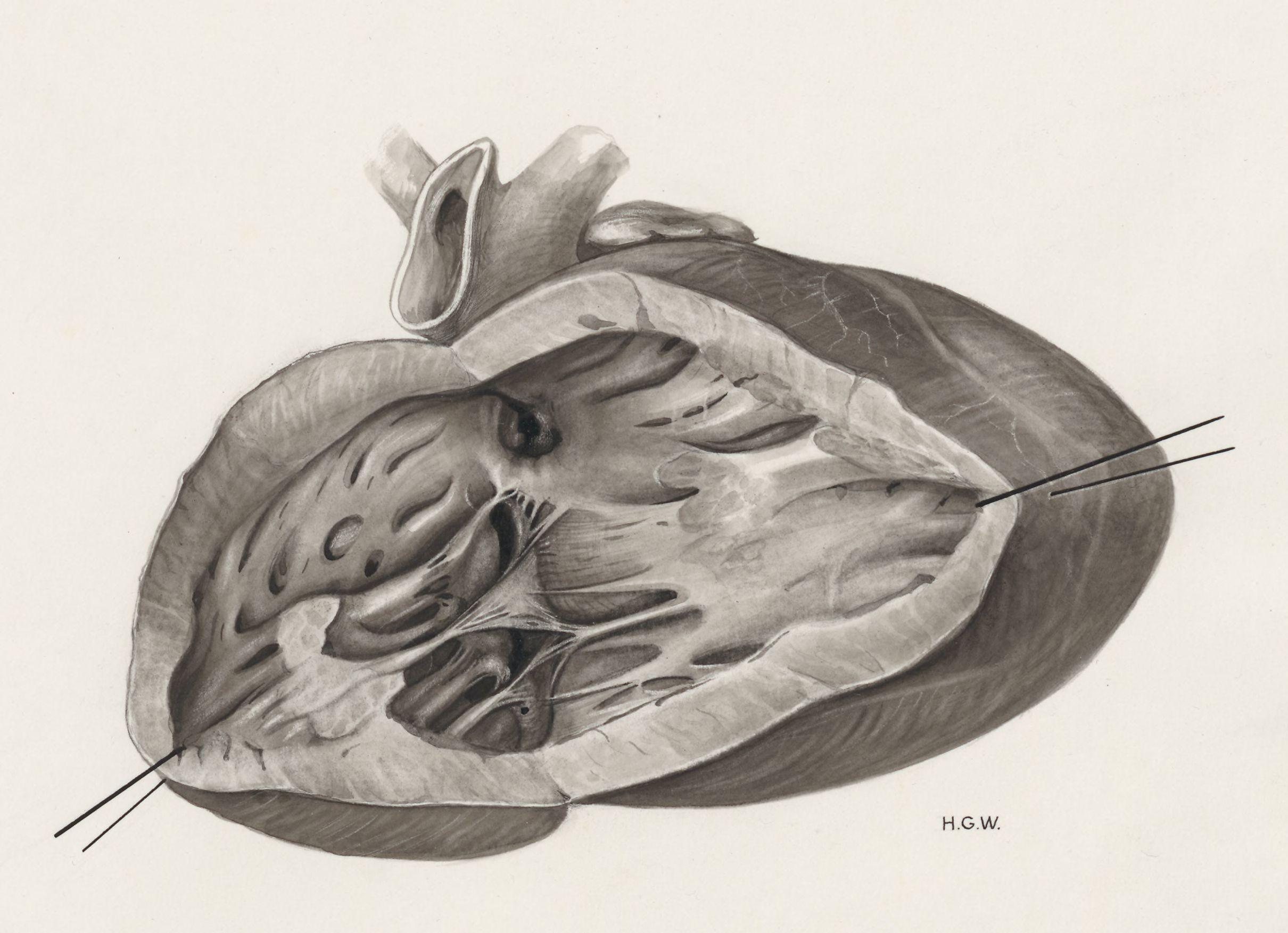 Heart and adjacent organs
