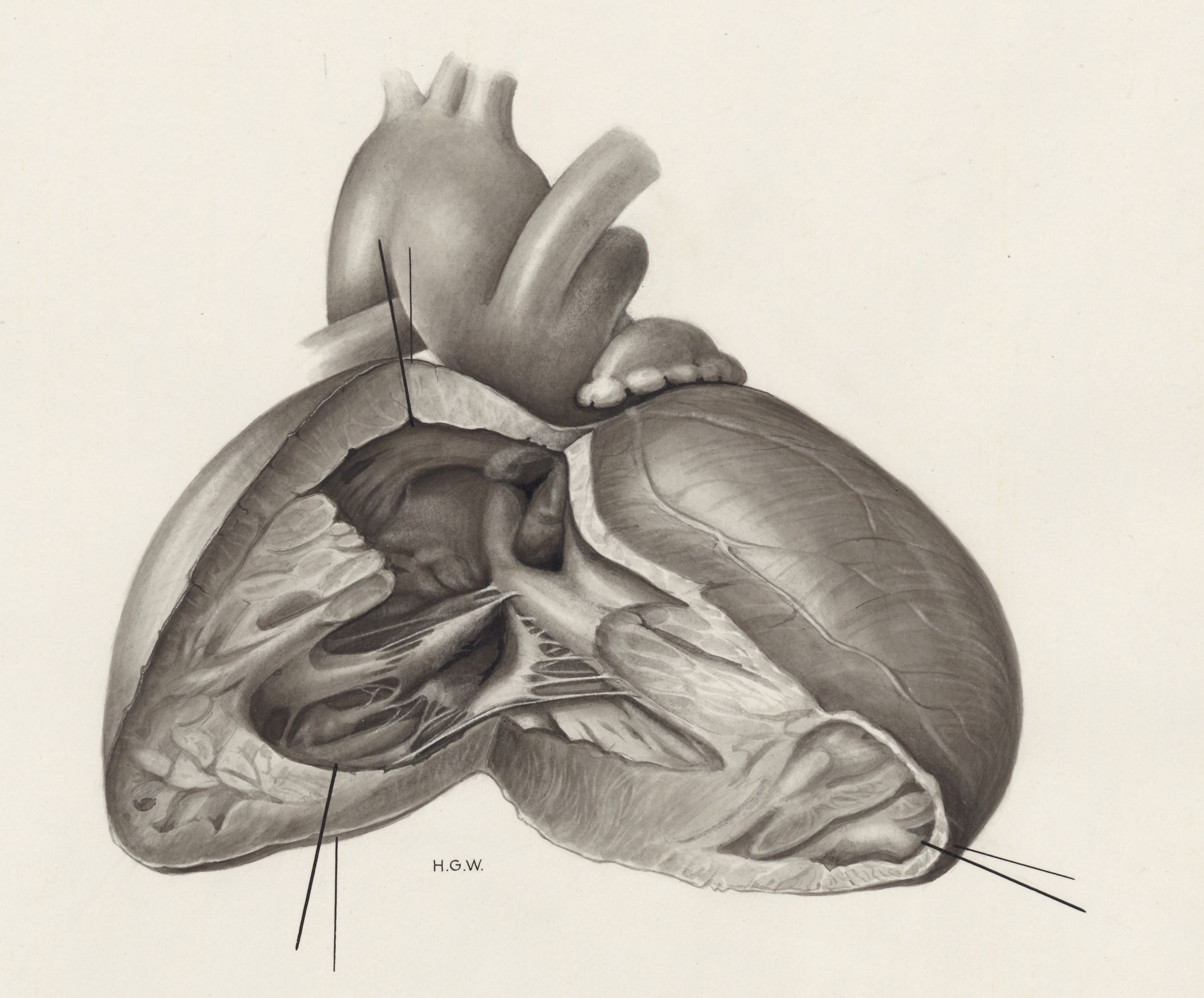Heart and adjacent organs