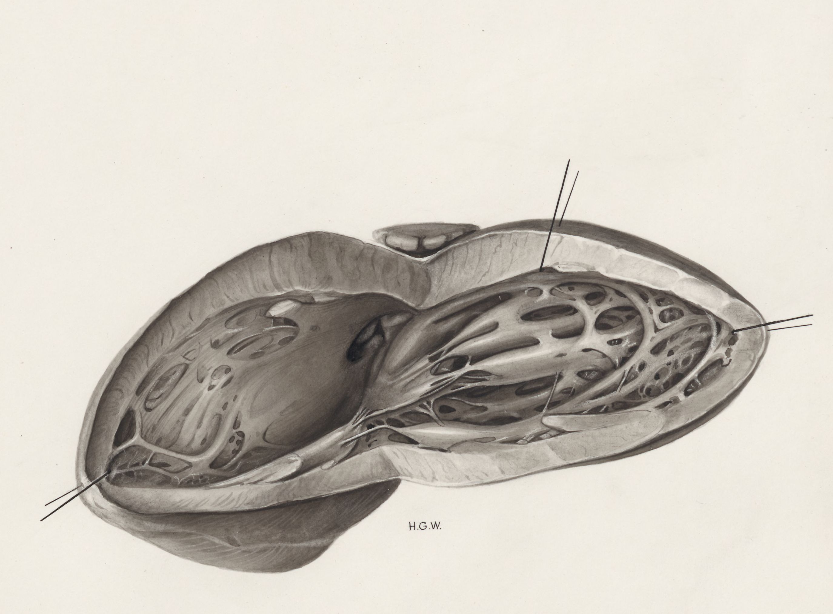Heart and adjacent organs