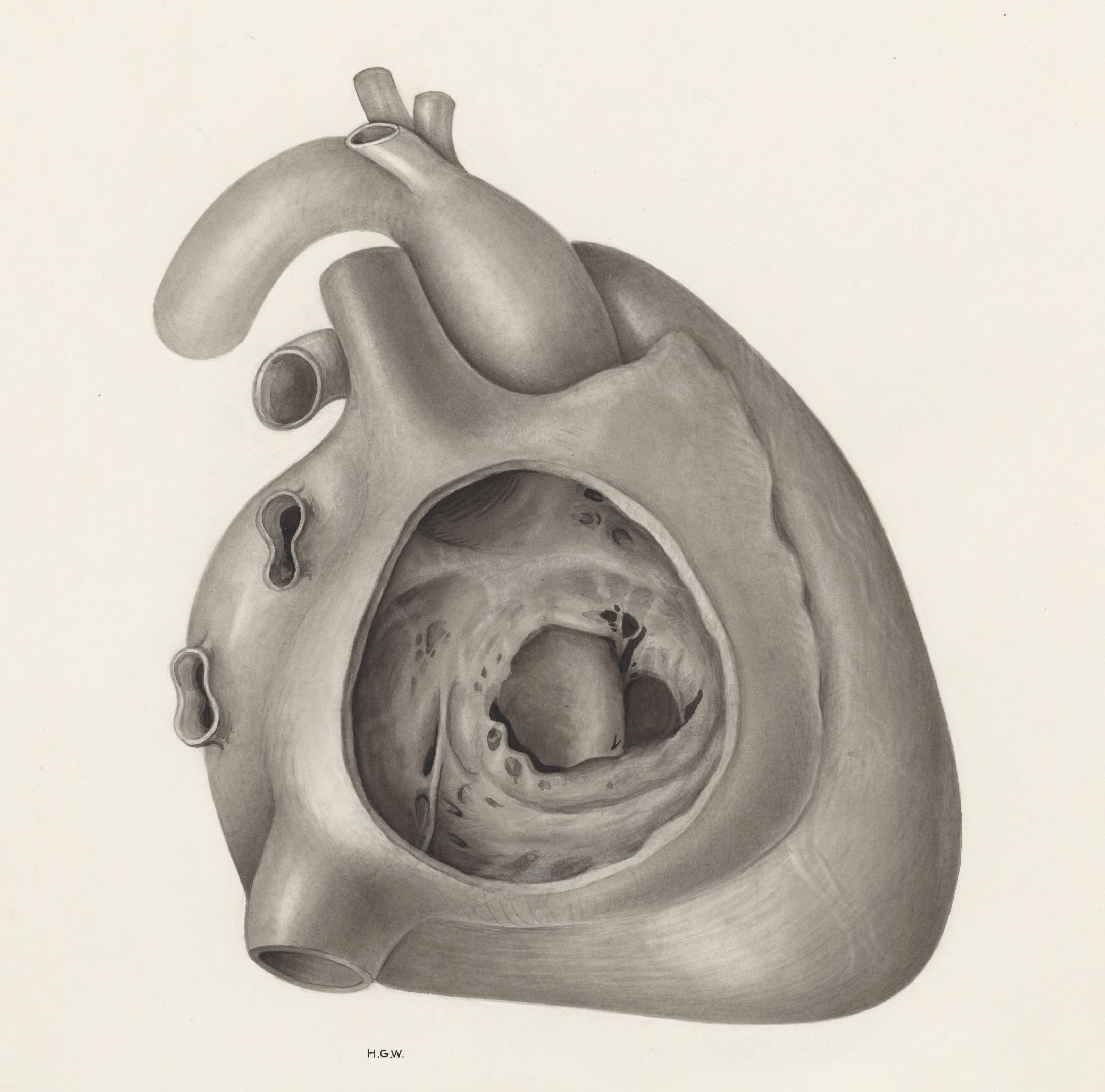Heart and adjacent organs