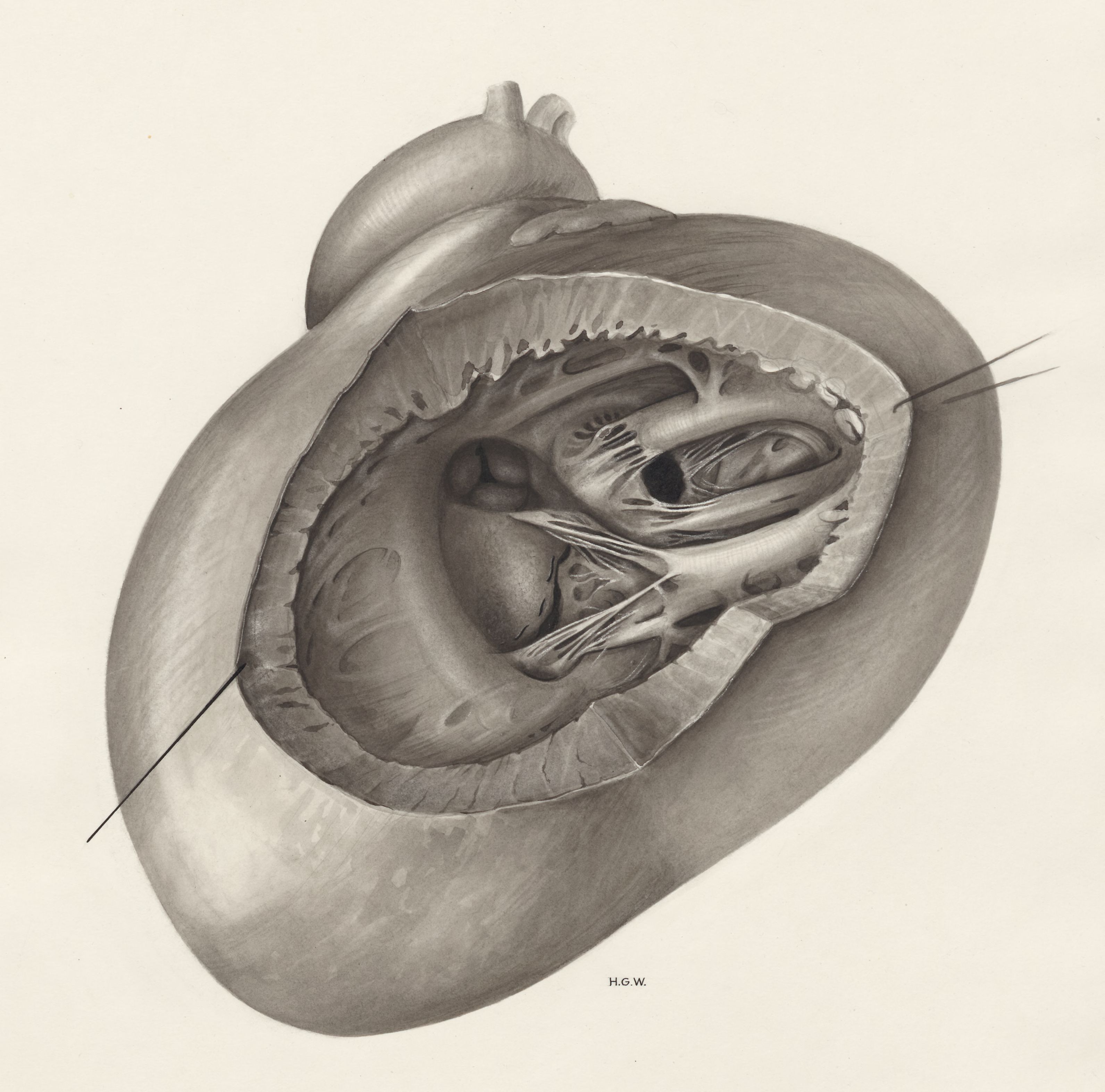 Heart and adjacent organs