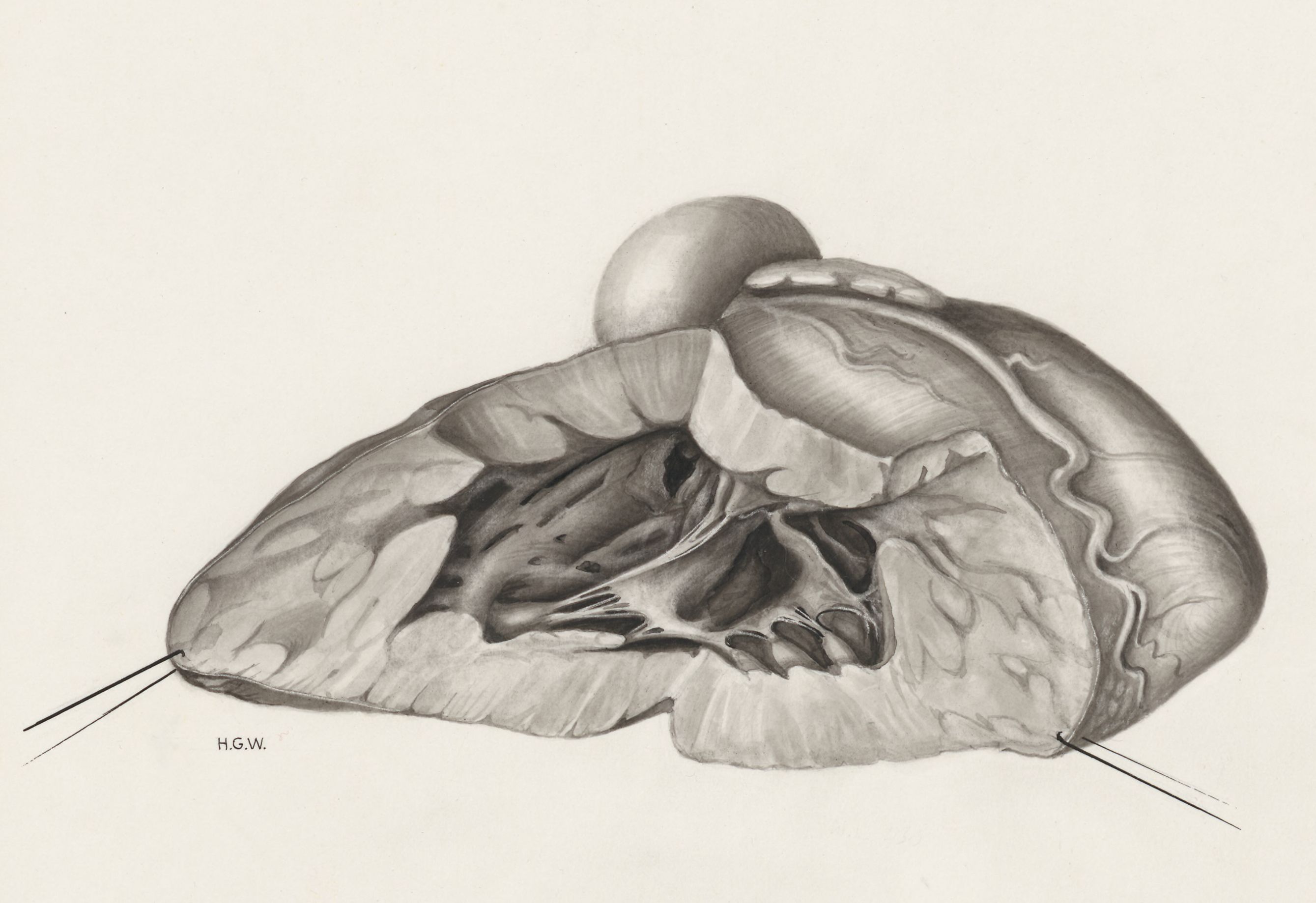 Heart and adjacent organs