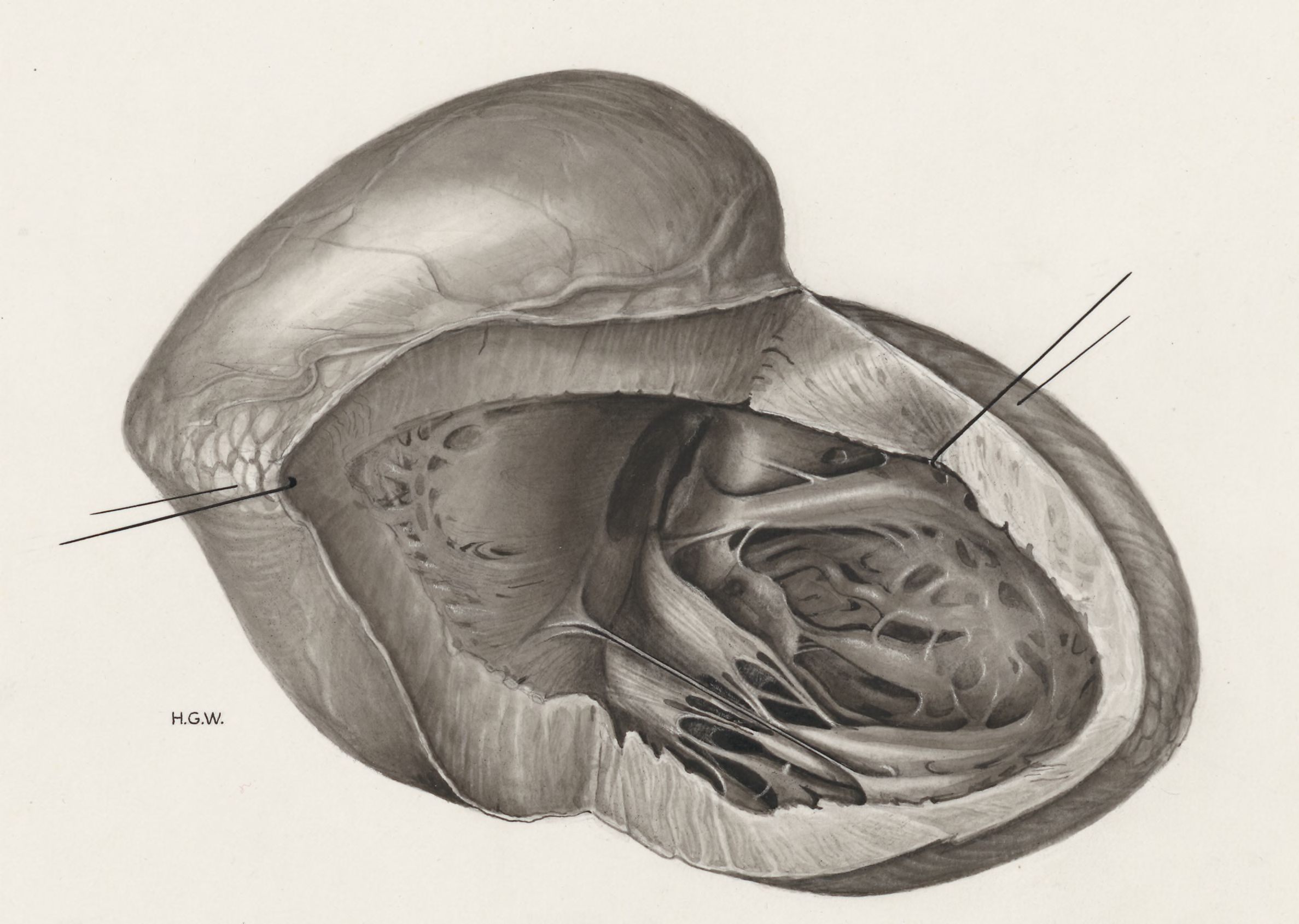 Heart and adjacent organs
