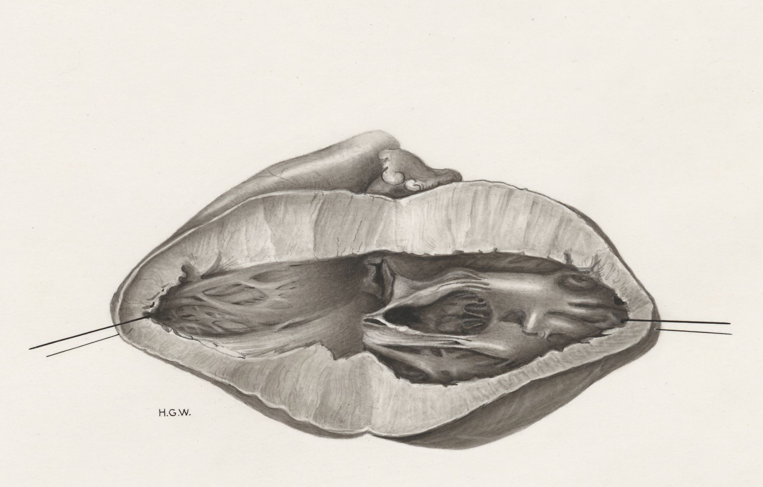 Heart and adjacent organs