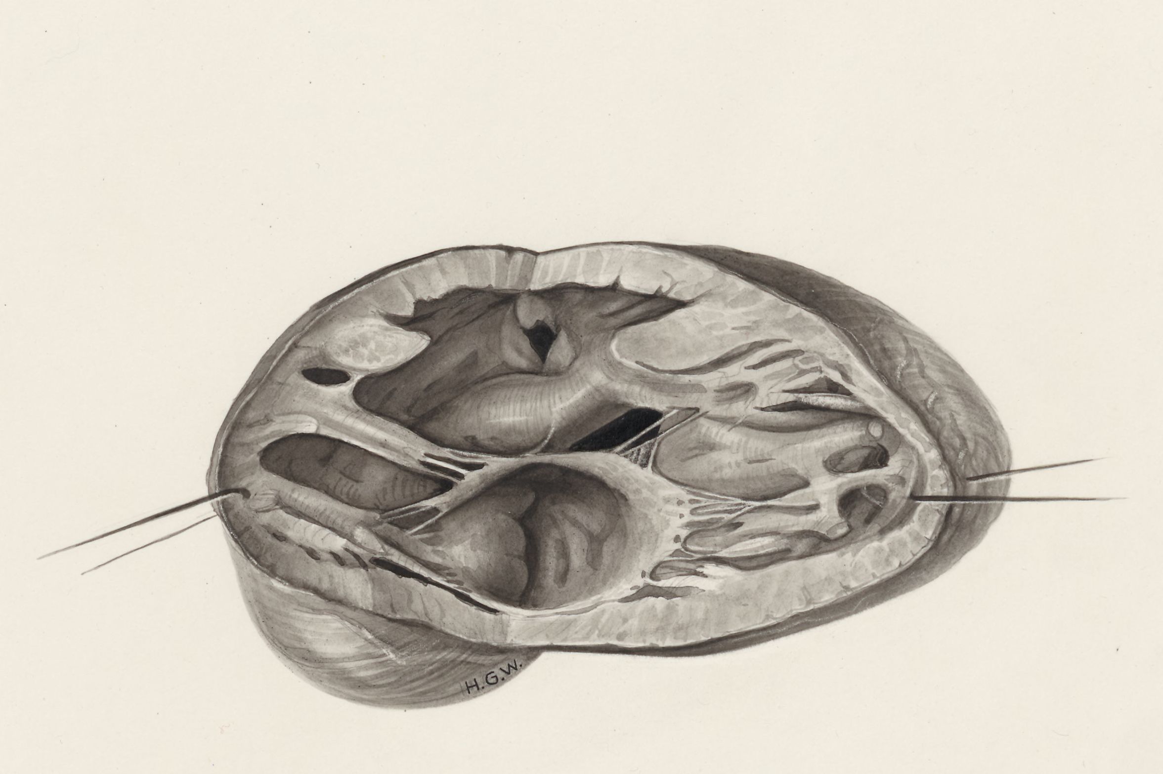 Heart and adjacent organs