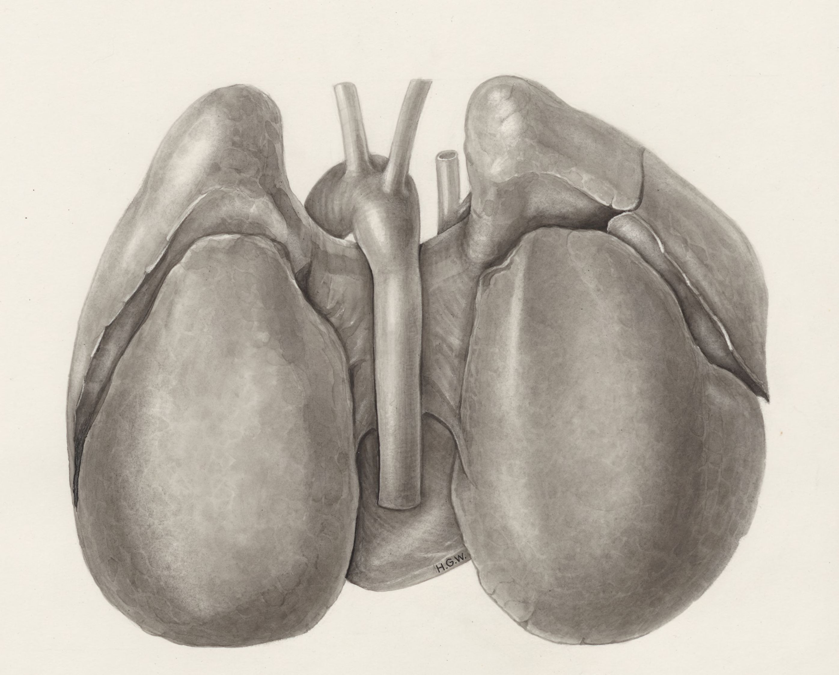 Heart and adjacent organs
