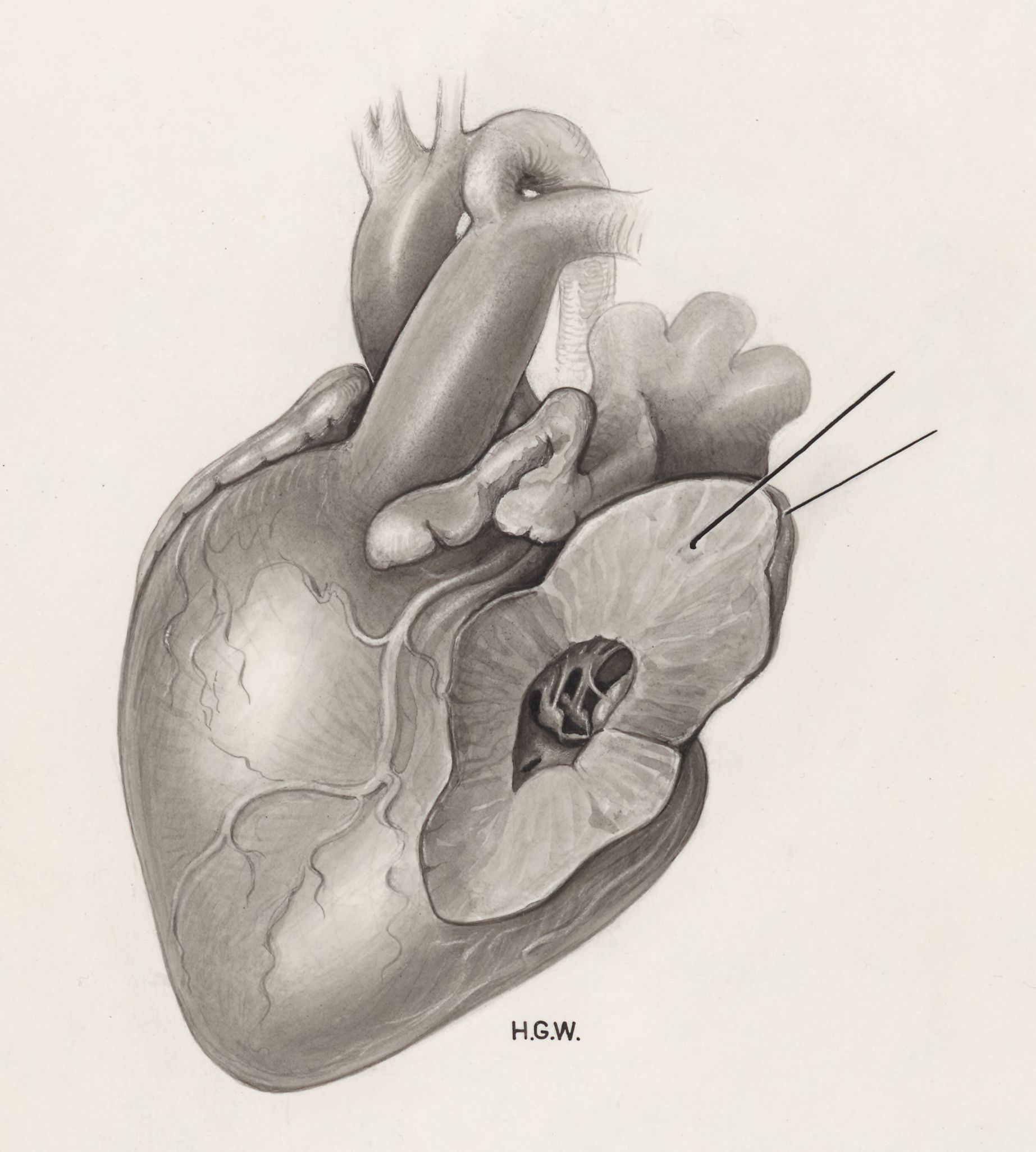 Heart and adjacent organs