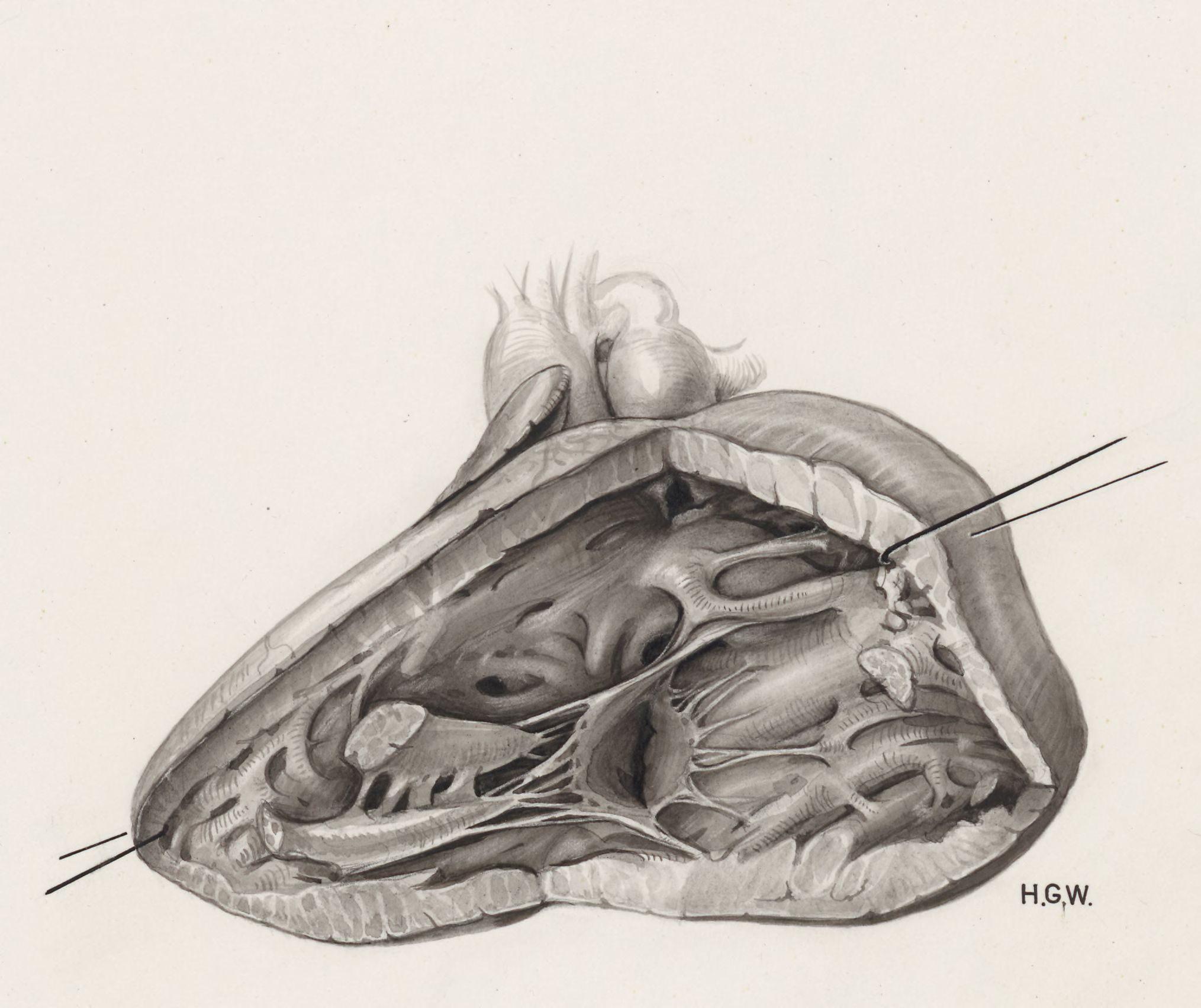 Heart and adjacent organs