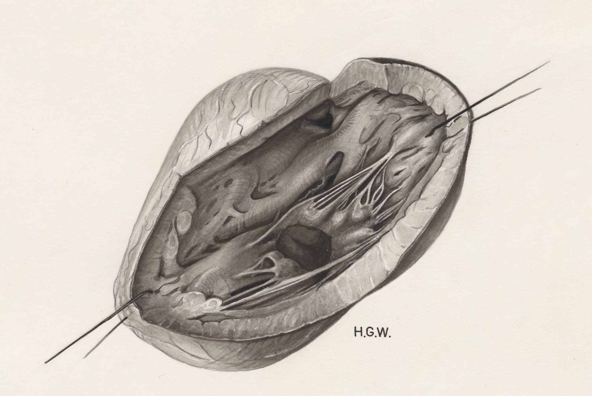 Heart and adjacent organs