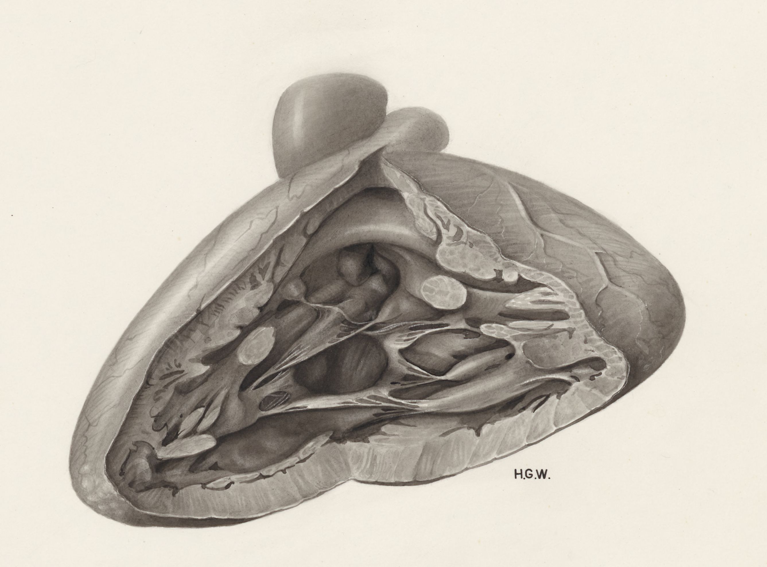 Heart and adjacent organs