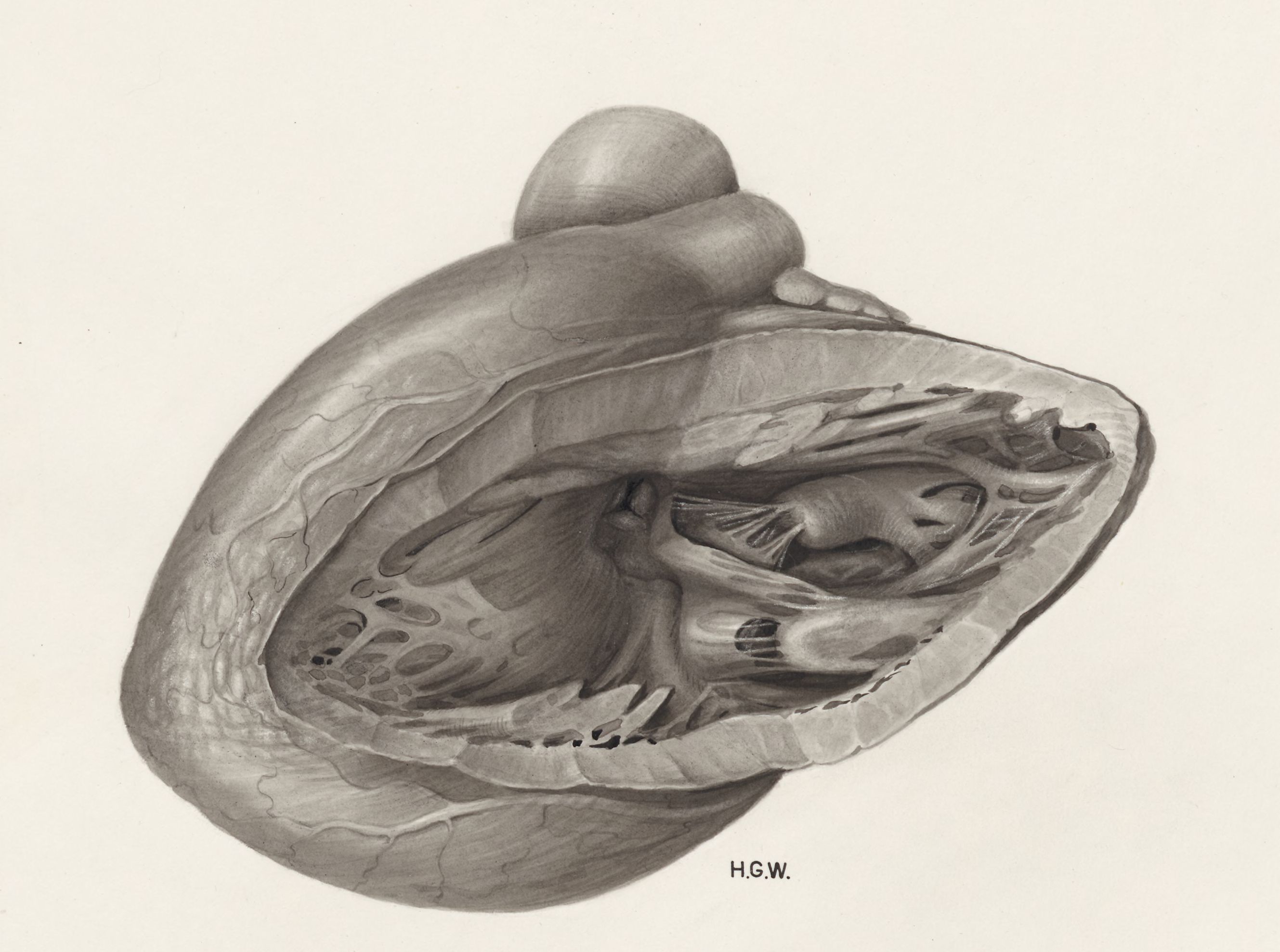 Heart and adjacent organs