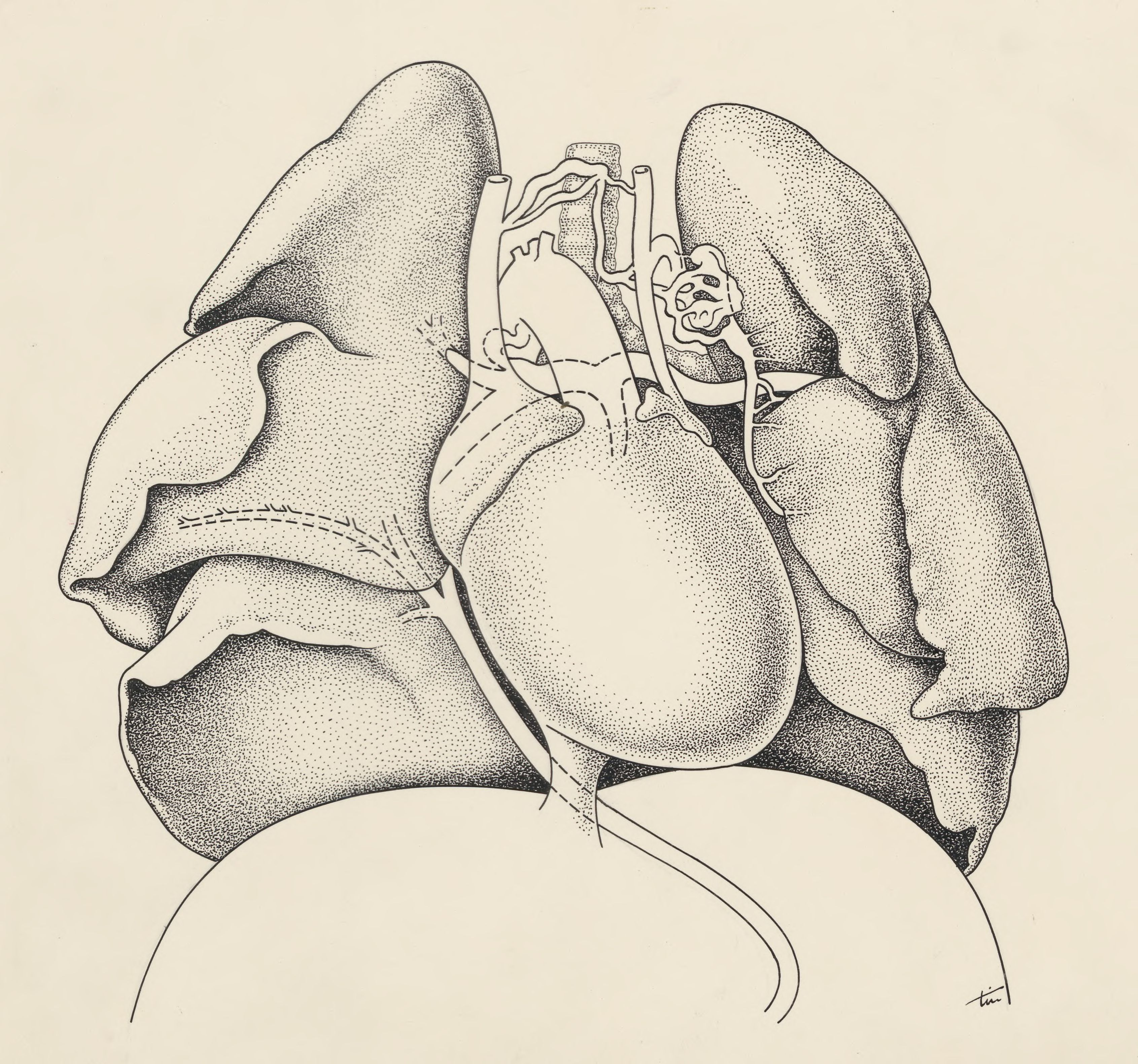 Heart and adjacent organs