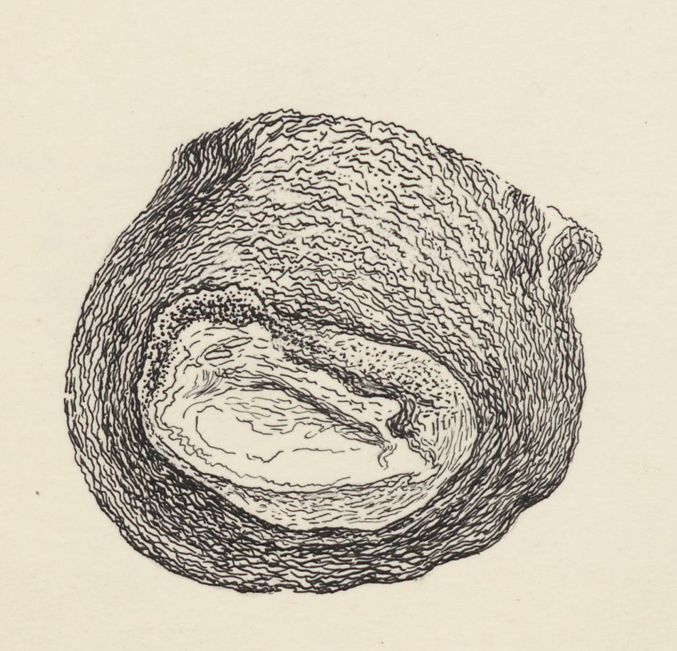 Part of the heart and circulatory system