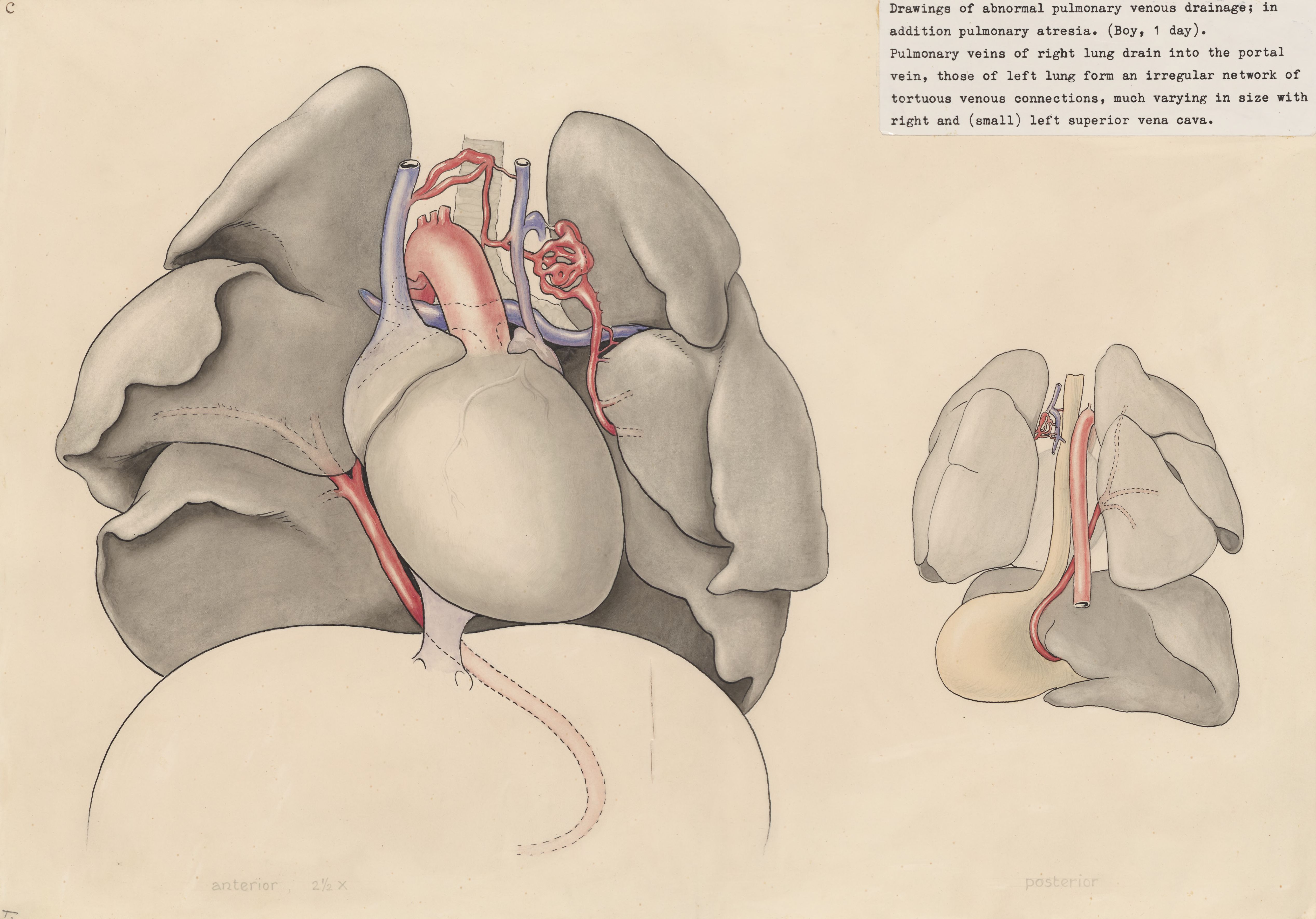 Heart and adjacent organs