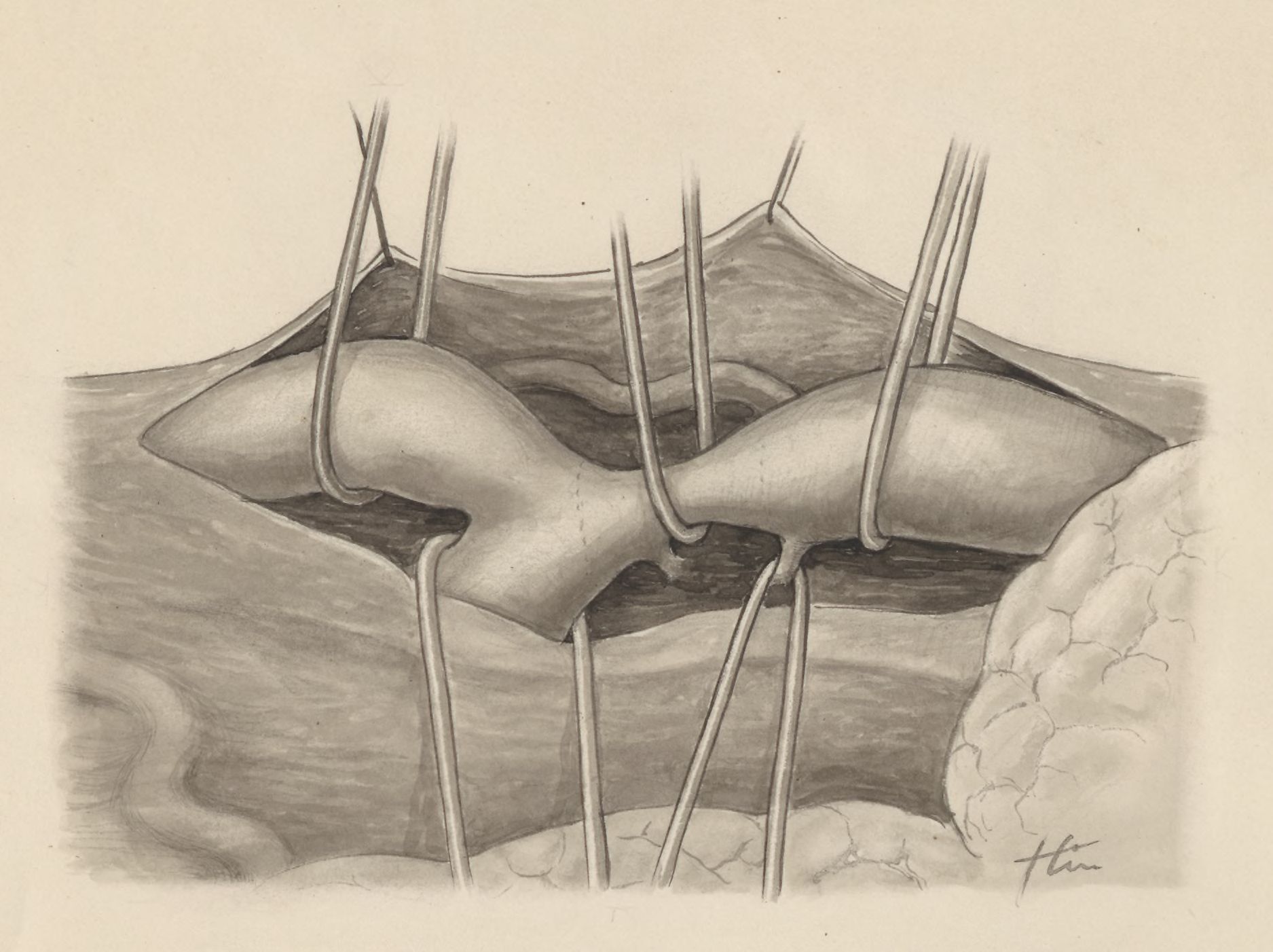 Heart and adjacent organs