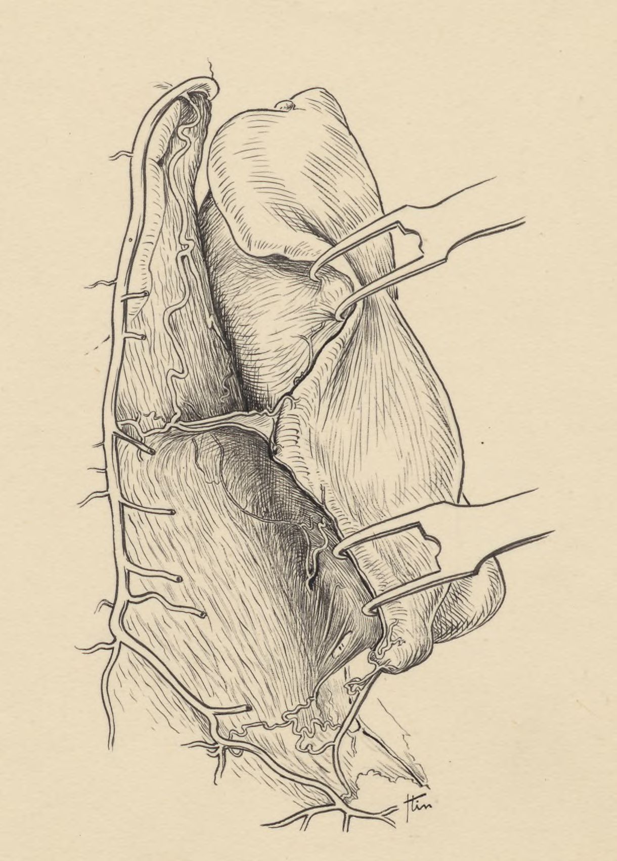 Part of the heart and circulatory system