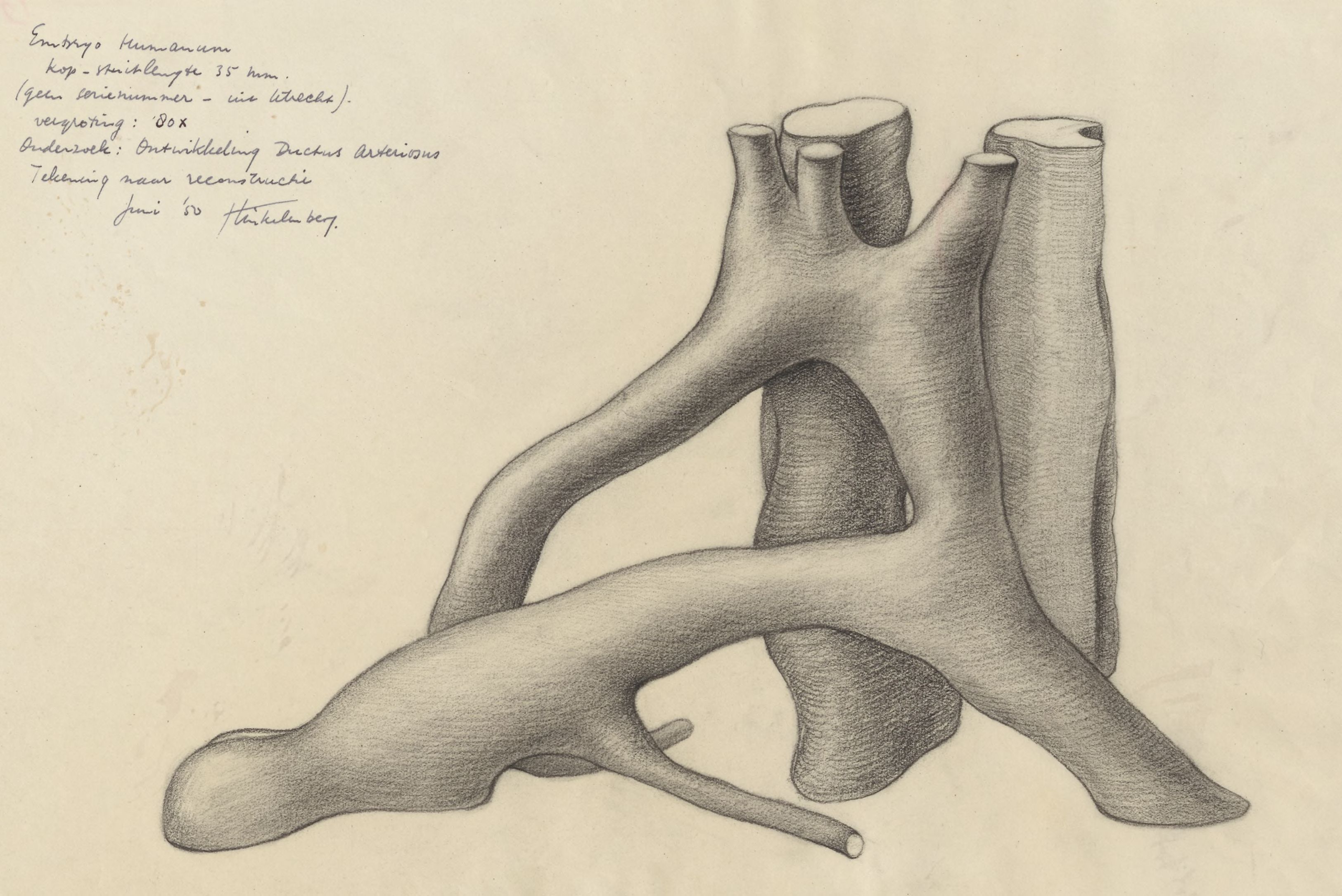 Ductus arteriosus