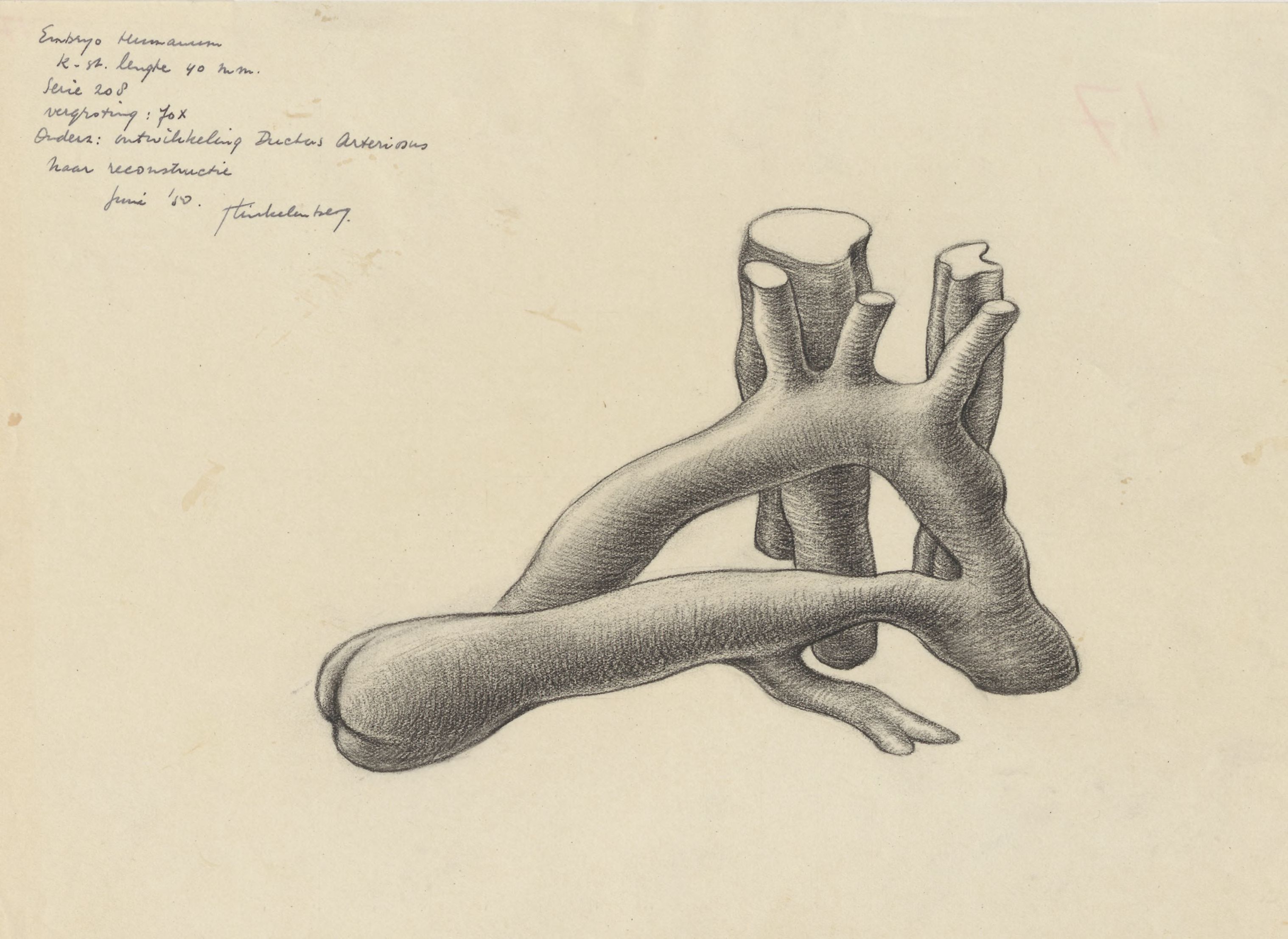 Ductus arteriosus