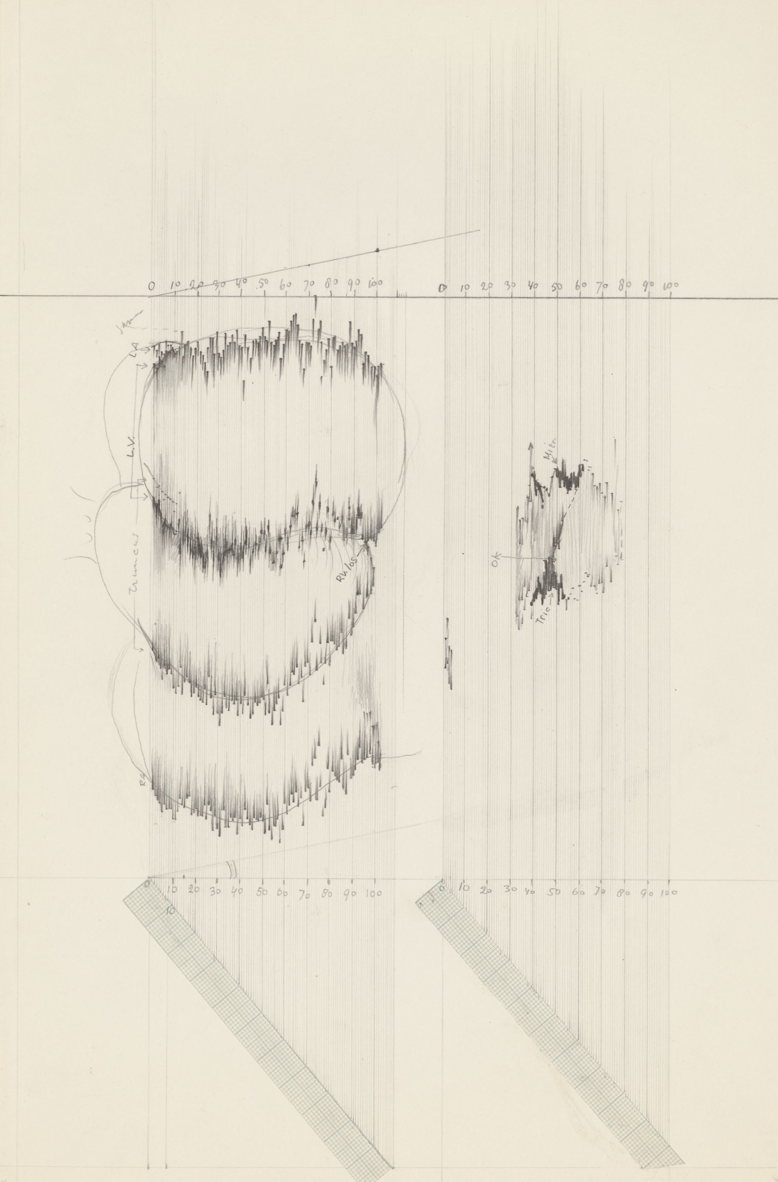 Embryonic heart
