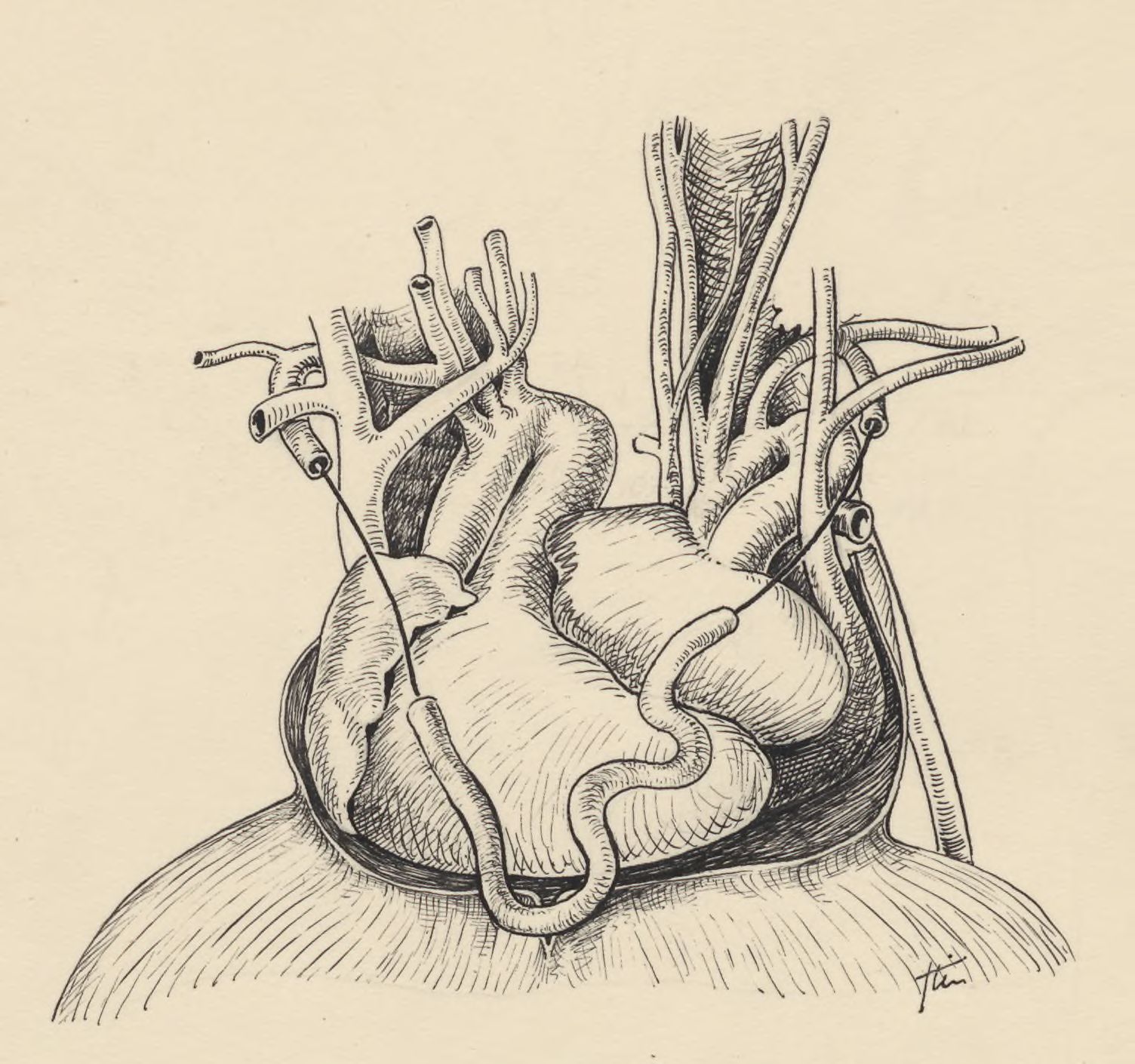 Part of the heart and circulatory system