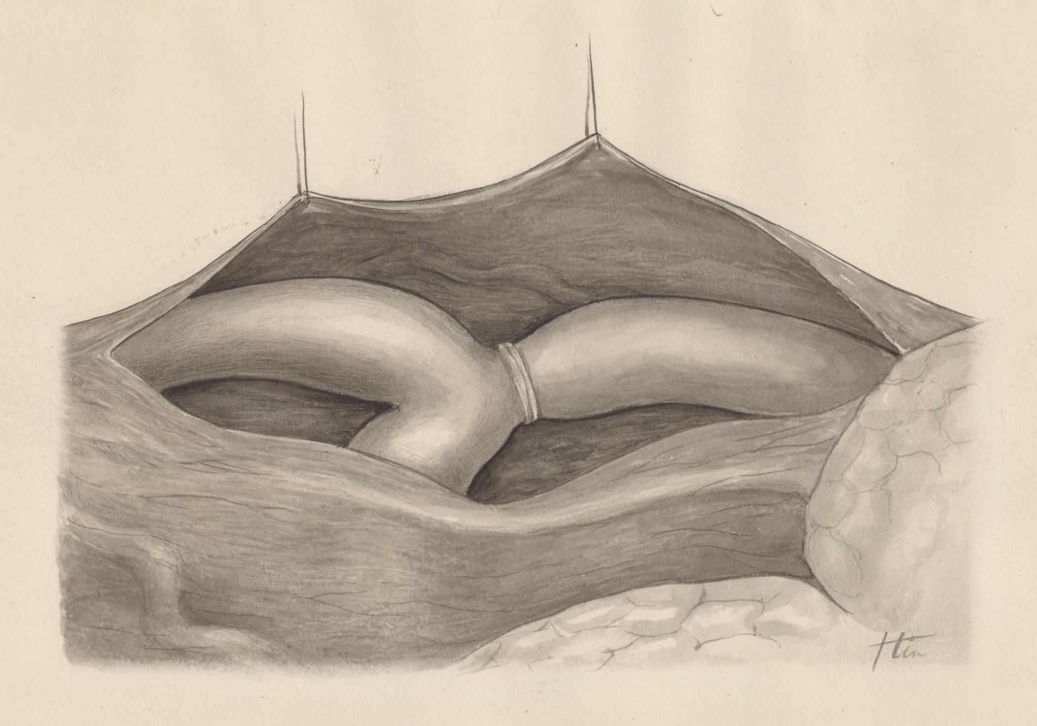 Part of the heart and circulatory system